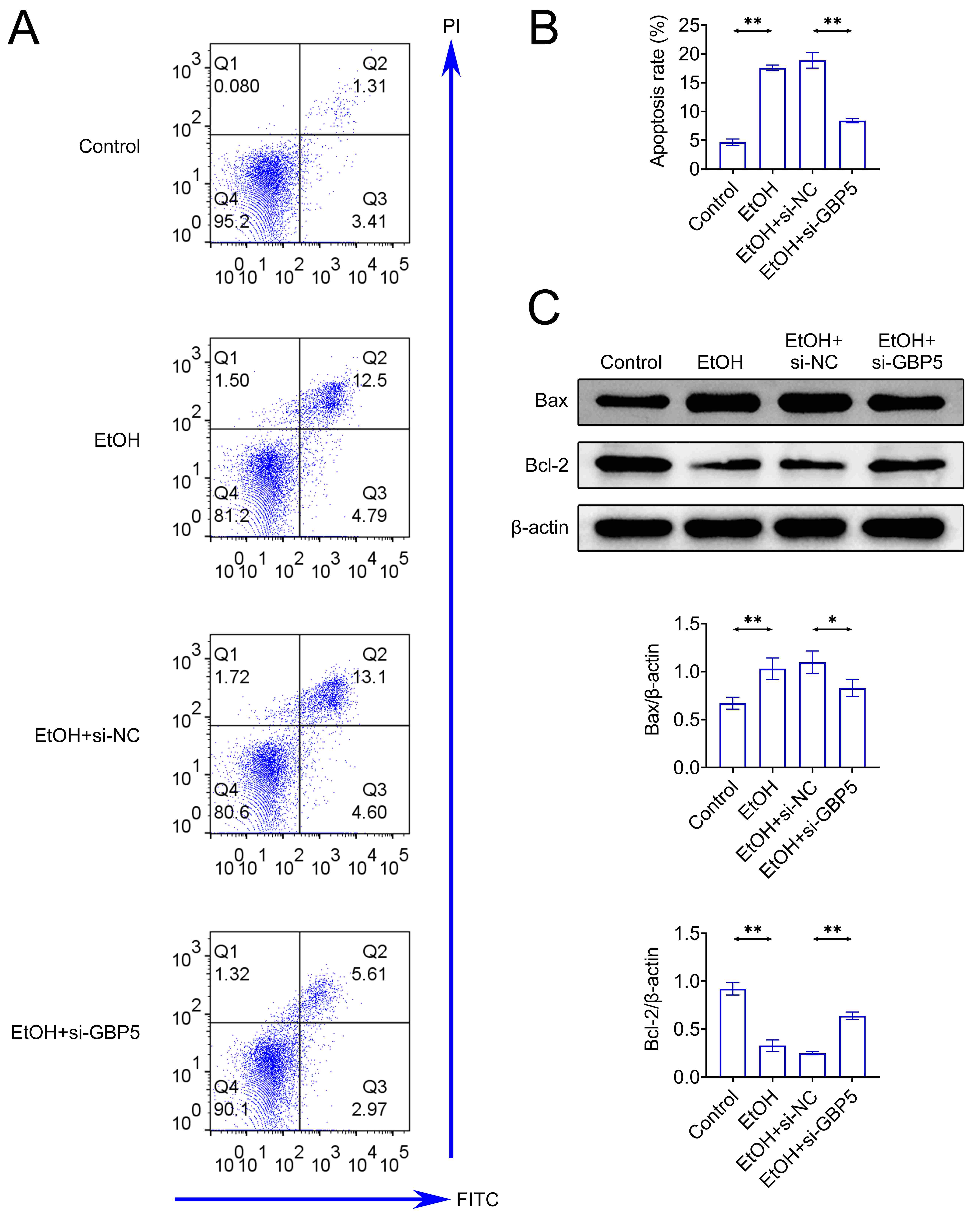 Suppression of GBP5 inhibited EtOH-triggered apoptosis. (A, B) Cell
apoptosis was assessed through flow
cytometry. (C) The protein expressions of B-cell lymphoma-2-associated X
(Bax) and B-cell lymphoma-2 (Bcl-2) were evaluated through
western blot. *p < 0.05, **p < 0.01.
GBP5: Guanylate binding protein 5; EtOH-Ethyl Alcohol; si-GBP5: siRNAs
used to target GBP5; si-NC: siRNAs used to a negative control.