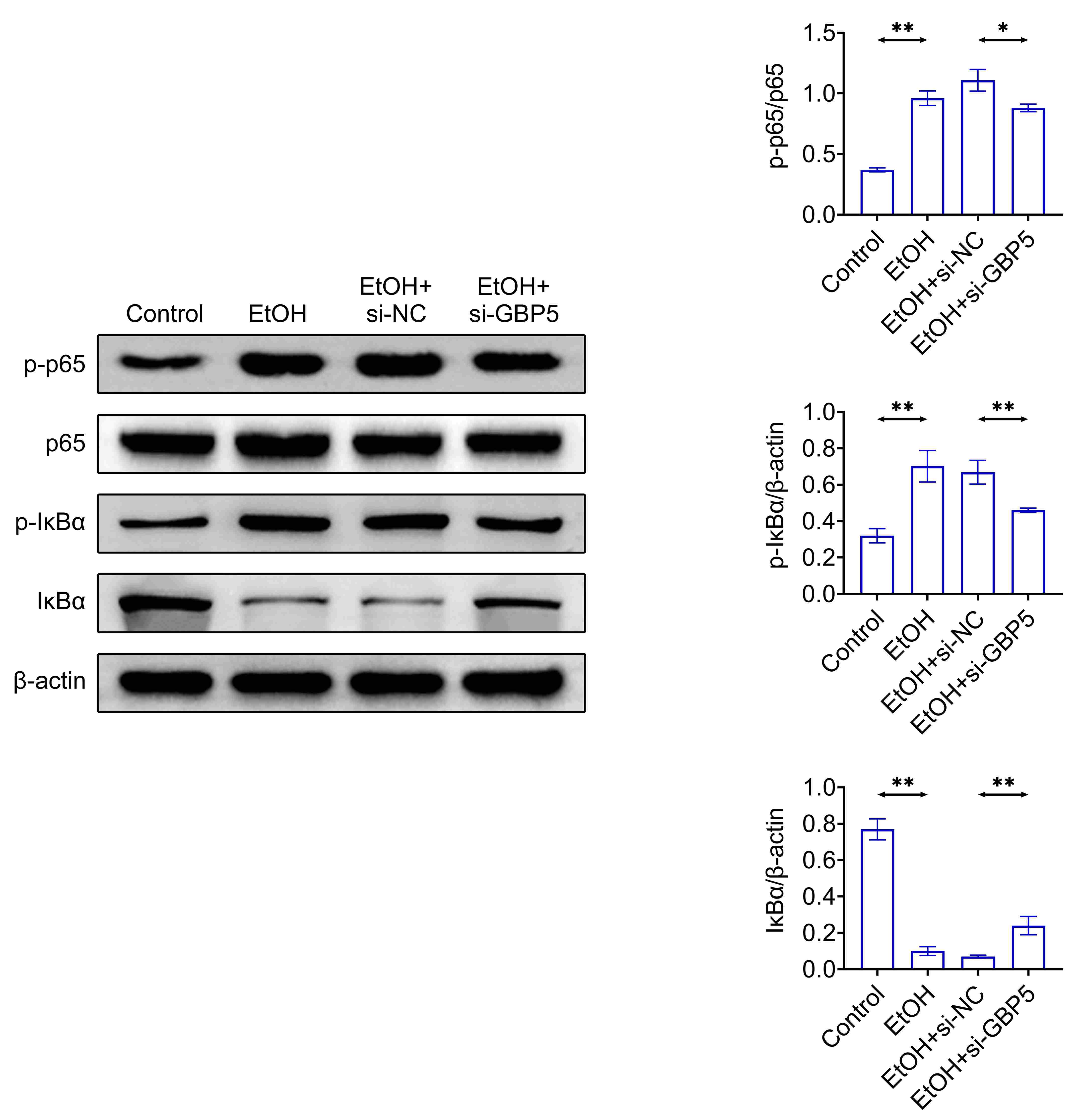 Knockdown of GBP5
retarded the nuclear factor kappa-B (NF-κB) pathway. The protein
expressions were examined through western blot. *p < 0.05,
**p < 0.01. GBP5: Guanylate binding protein 5;
EtOH-Ethyl Alcohol; si-GBP5: siRNAs used to target GBP5; si-NC: siRNAs
used to a negative control.
