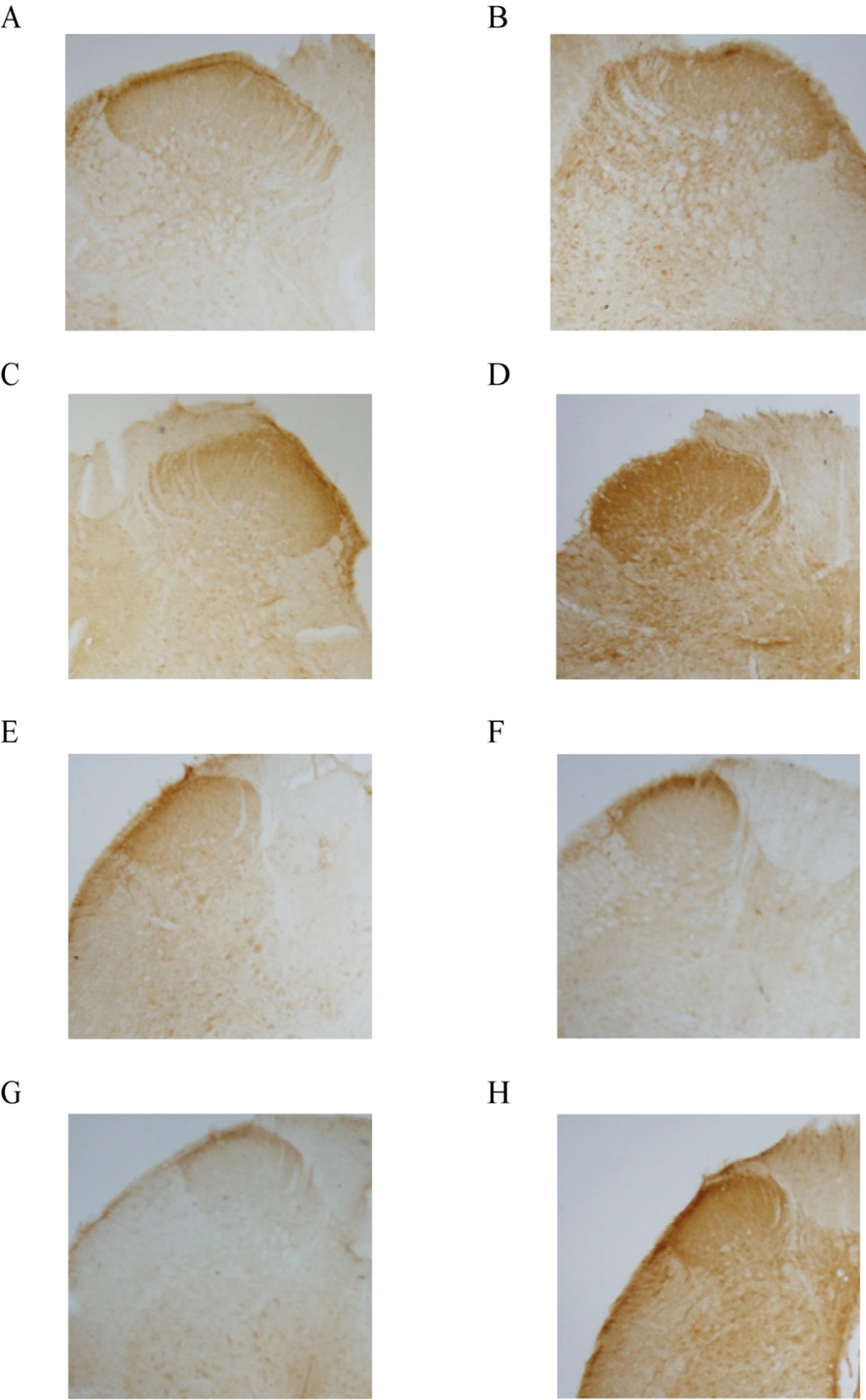 Expression of Substance P 
(SP) in the posterior horn of the L5–S2 spinal cord in different groups of rats 
(IHC: 40×). (A) L5 in the control group; (B) L5 in the 60 d modeling 
group; (C) L6 in the control group; (D) L6 in the 60 d modeling group; (E) S1 in 
the 60 d modeling group; (F) S1 in the 90 d modeling group; (G) S2 in the control 
group; (H) S2 in the 90 d modeling group.