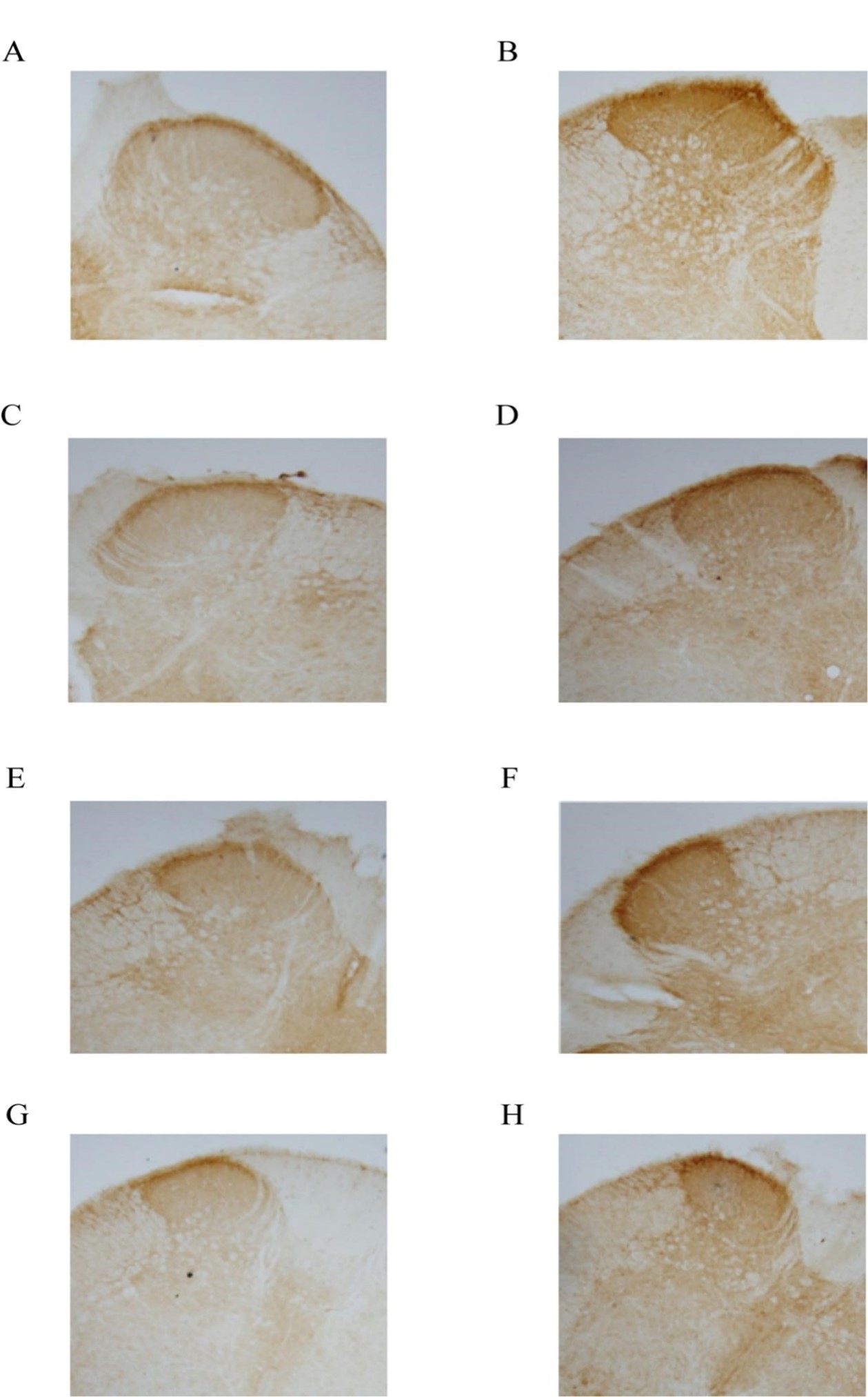 Expression of neurokinin-1 
receptor (NK-1R) in the posterior horn of the L5–S2 spinal cord in different 
groups of rats (IHC: 40×). (A) L5 in the control group; (B) L5 in the 
90 d modeling group; (C) L6 in the control group; (D) L6 in the 45 d modeling 
group. (E) S1 in the control group; (F) S1 in the 90 d modeling group; (G) S2 in 
the control group; (H) S2 in the 60 d modeling group.