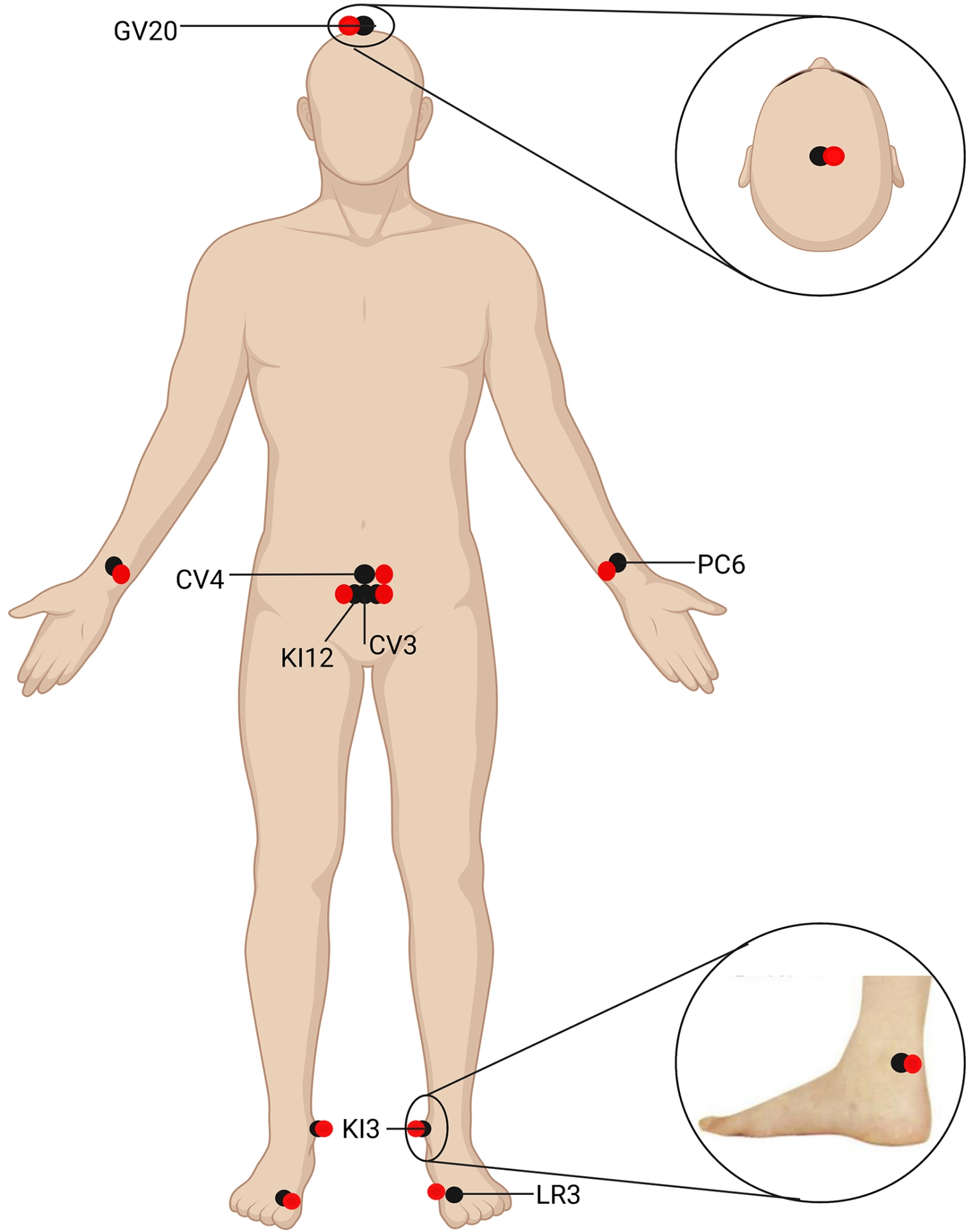 Acupoint selection in the acupuncture and sham acupuncture 
groups. The black circles represent the acpoints selected by the acupuncture 
group, the red circles represent the acpoints selected by the sham acupuncture 
group. (Created with BioRender.com).