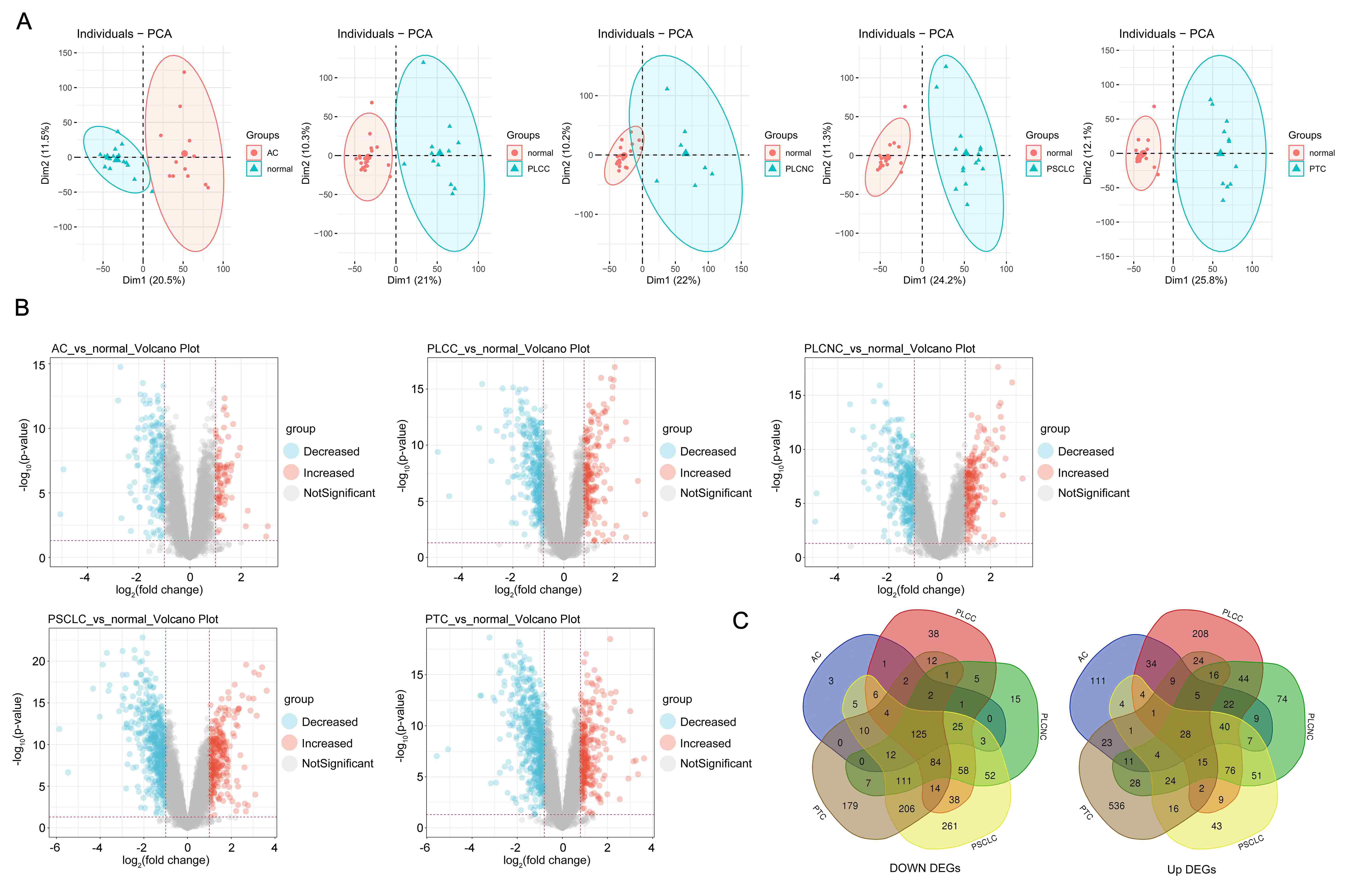 Analysis of differential genes DEGs in lung cancer based on GEO
data. (A) PCA was used to analyze the difference between normal and lung cancer,
including AC (adenocarcinoma), PTC (primary typical carcinoid), PLCC (primary
large cell carcinoma), PLCNC (primary large cell lung carcinoma) and PSCLC
(primary small cell lung carcinoma). (B) Volcano plot was used to assess DEGs
between normal and different types of lung cancer. Blue: decreased expression
genes, red: increased expression genes, grey: no significant change expression
genes. (C) Venn plot analyzed the intersection genes among AC (adenocarcinoma),
PTC (primary typical carcinoid), PLCC (primary large cell carcinoma), PLCNC
(primary large cell lung carcinoma) and PSCLC (primary small cell lung
carcinoma).