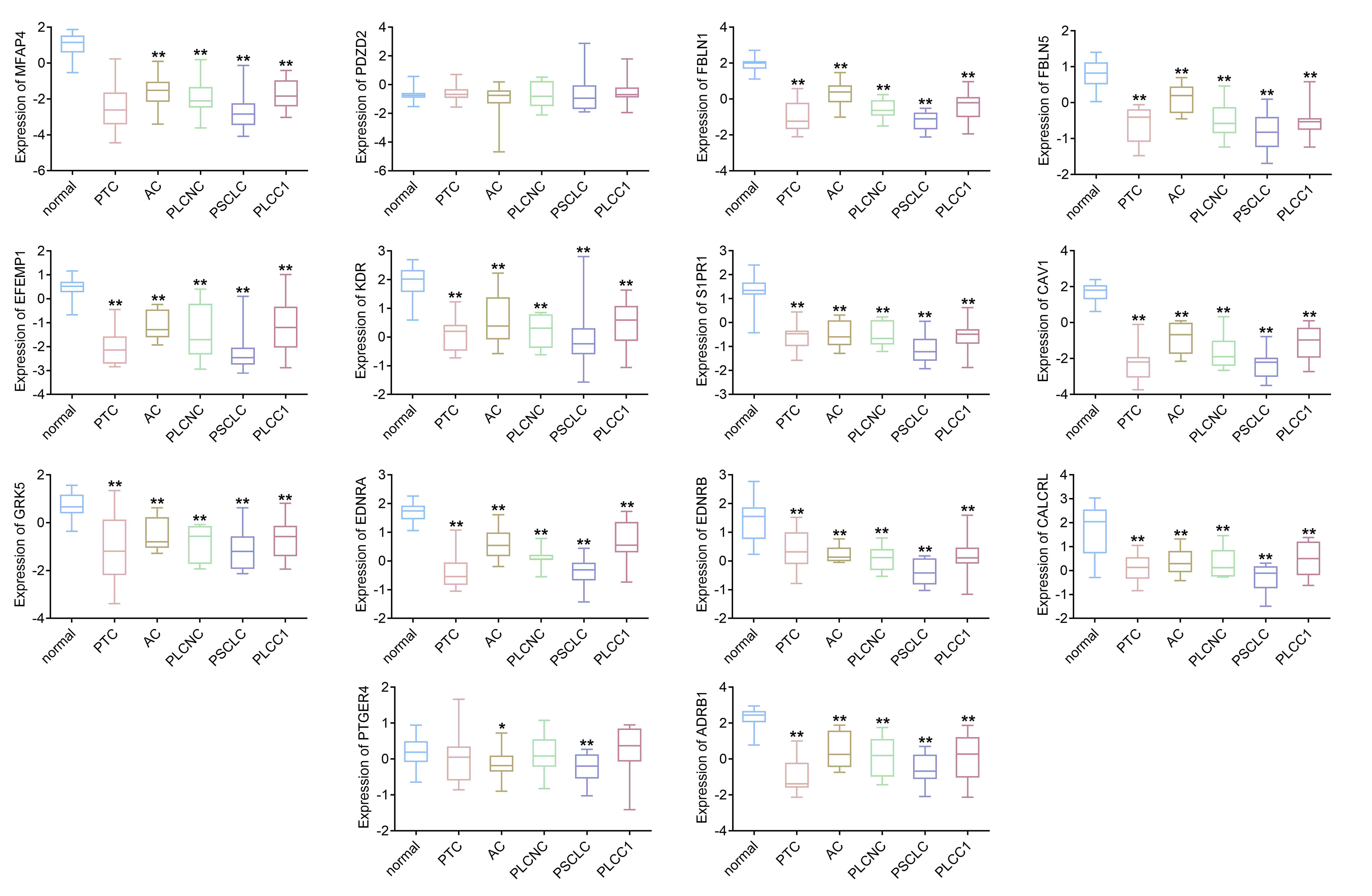 Expression of key genes in different subtypes of lung cancer. Box plot was used to analyze the expression of MFAP4 (microfibril-associated
protein 4), PDZD2 (PDZ domain containing 2), FBLN1 (fibulin 1), FBLN5 (fibulin
5), EFEMP1 (EGF containing fibulin extracellular matrix protein 1), KDR (kinase
insert domain receptor), S1PR1 (sphingosine-1-phosphate receptor 1), CAV1
(caveolin 1), GRK5 (G protein-coupled receptor kinase 5), EDNRA (endothelin
receptor type A), EDNRB (endothelin receptor type B), CALCRL (calcitonin
receptor-like receptor), PTGER4 (prostaglandin E receptor 4), and ADRB1
(adrenoceptor beta 1) in different types of lung cancer from GSE1037.