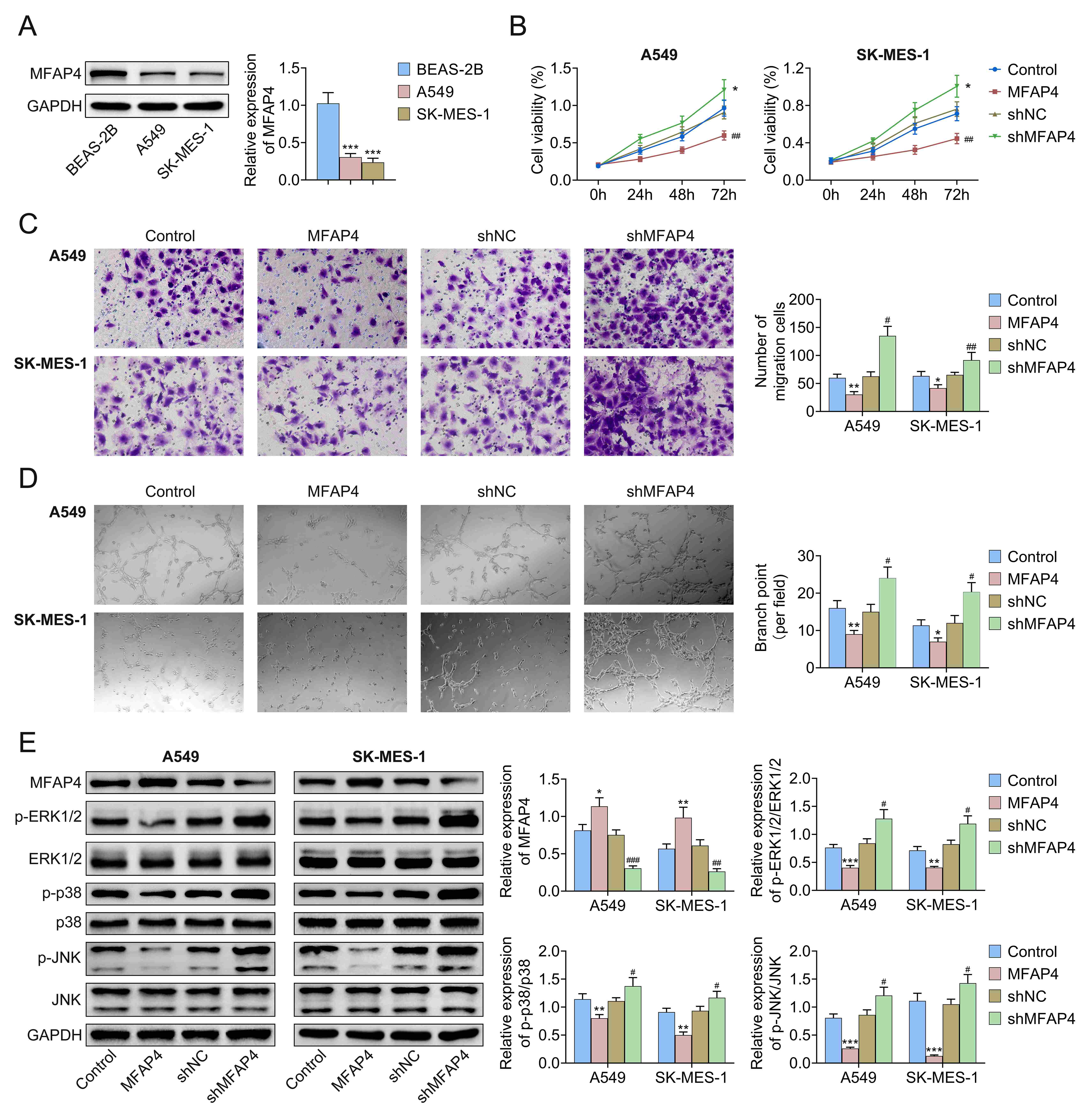 Effects of upregulated MFAP4 on angiogenesis and MAPK pathway in
lung cancer cells. (A) The expression of MFAP4 was assessed in BEAS-2B, A549 and
SK-MES-1 via western blotting. (B) A549 and SK-MES-1 were divided into four
groups (Control, MFAP4, shNC and shMFAP4) depending on different plasmids
transfection. Cell proliferation of the cell line was assessed by MTT assay. (C)
A549 and SK-MES-1 were transfected with the indicated plasmids, and transwell
assay was performed to assess cell migration with quantitative data attachment.
(D) Human umbilical vein endothelial cells (HUVECs) were cultured with a
transfected medium of lung cancer cells to conduct tubule formation experiments
with quantitative data attachment. (E) The related protein expression was
measured by western blotting. Quantitative protein expression (MFAP4, p-ERK1/2,
p-p38, and p-JNK (c-Jun N-terminal kinases)) data is attached. Error bars
represent data from three independent experiments (mean ± SD). ##p <
0.01. **p < 0.01. #compared to the control group. *compared to the shNC
group.