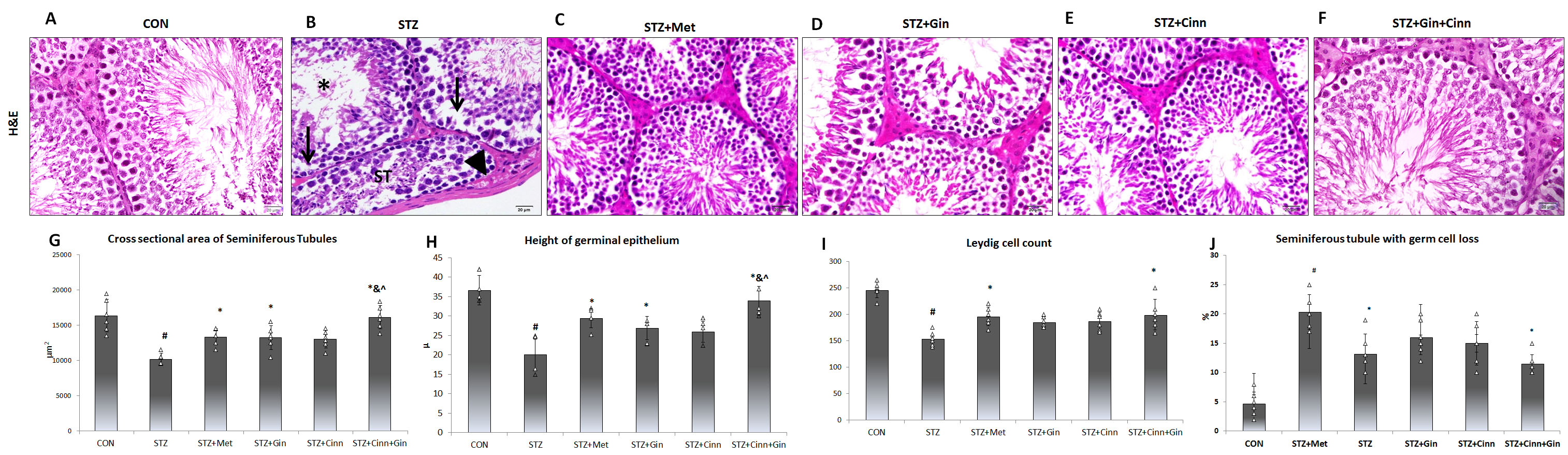 Effect of Cinnamon and ginger extracts on the
histological structure of the testis. (A–F) show the histological structure of
the testis of the study groups. The area of the seminiferous tubules (G) and the
height of the germinal epithelium (H) is presented. Testis of STZ-treated rat (B)
shows tubular deformity and shrinkage of some STs (ST). Many germinal epithelials
cells were degenerated (arrow) with reduced spermatozoa number in the STs lumen
(asterisk). The interstitial connective tissue appears congested (arrow head).
These changes are less frequent in the treated groups (C–F). The cross sectional
area of ST (G), Height of germinal epithelium (H), Leydig cell count (I) and ST
with germ cell loss (J) are presented in graphs. STZ: streptozotocin; Met:
metformin; Gin: ginger; Cinn: Cinnamon. N = 6. Mean ± SD is presented.
Analysis of varience test was done followed by Bonforoni
post-hoc test. #: significant versus control; *: significant
versus STZ + Met; &: significant versus STZ + Gin; ^:
significant versus STZ + Cinn.