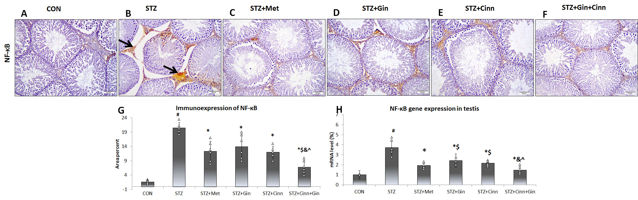 Effect of Cinnamon and ginger extracts on
immunoexpression of NF-κB in the testis. Immunoexpression of testicular
NF-κB (A–F) in the study groups is presented. NF-κB + ve cells
(arrow) frequently appear in the interstitial cells of STZ group (B).
Semi-quantitative assessment of NF-κB immunoexpression is presented (G).
Gene expression analysis of NF-κB using qRT-PCR is presented (H).
NF-κB: nuclear factor kappa B; STZ: streptozotocin; Met: metformin; Gin:
ginger; Cinn: Cinnamon. N = 6. Mean ± SD is presented. ANOVA test followed
by Bonforoni post-hoc test was used. #: significant versus
control; *: significant versus STZ, $: significant versus STZ + Met; &:
significant versus STZ + Gin; ^: significant versus STZ + Cinn.