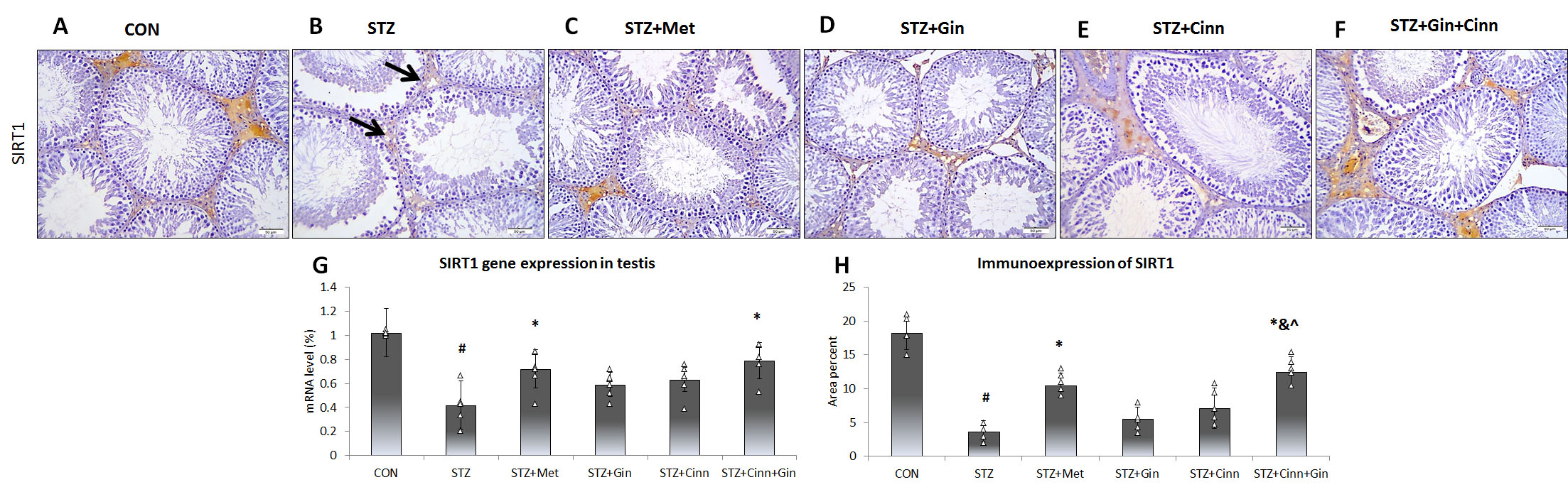 Effect of Cinnamon and ginger extracts onimmunoexpression of SIRT1 in the testis. Testicular immunoexpression of
SIRT1 (A–F) in testis of the study groups is presented. SIRT1 + ve cells (arrow)
less frequently appear in the interstitial cells of STZ group (B).
Semi-quantitative assessment of SIRT1 immunoexpression is presented (G). Gene
expression analysis of SIRT1 using qRT-PCR is presented (H). SIRT1: Sirtuin 1;
STZ: streptozotocin; Met: metformin; Gin: ginger; Cinn: Cinnamon. N = 6. Mean
± SD is presented. ANOVA test followed by Bonforoni
post-hoc test was used. #: significant versus control; *:
significant versus STZ + Met; &: significant versus STZ + Gin;
^: significant versus STZ + Cinn.