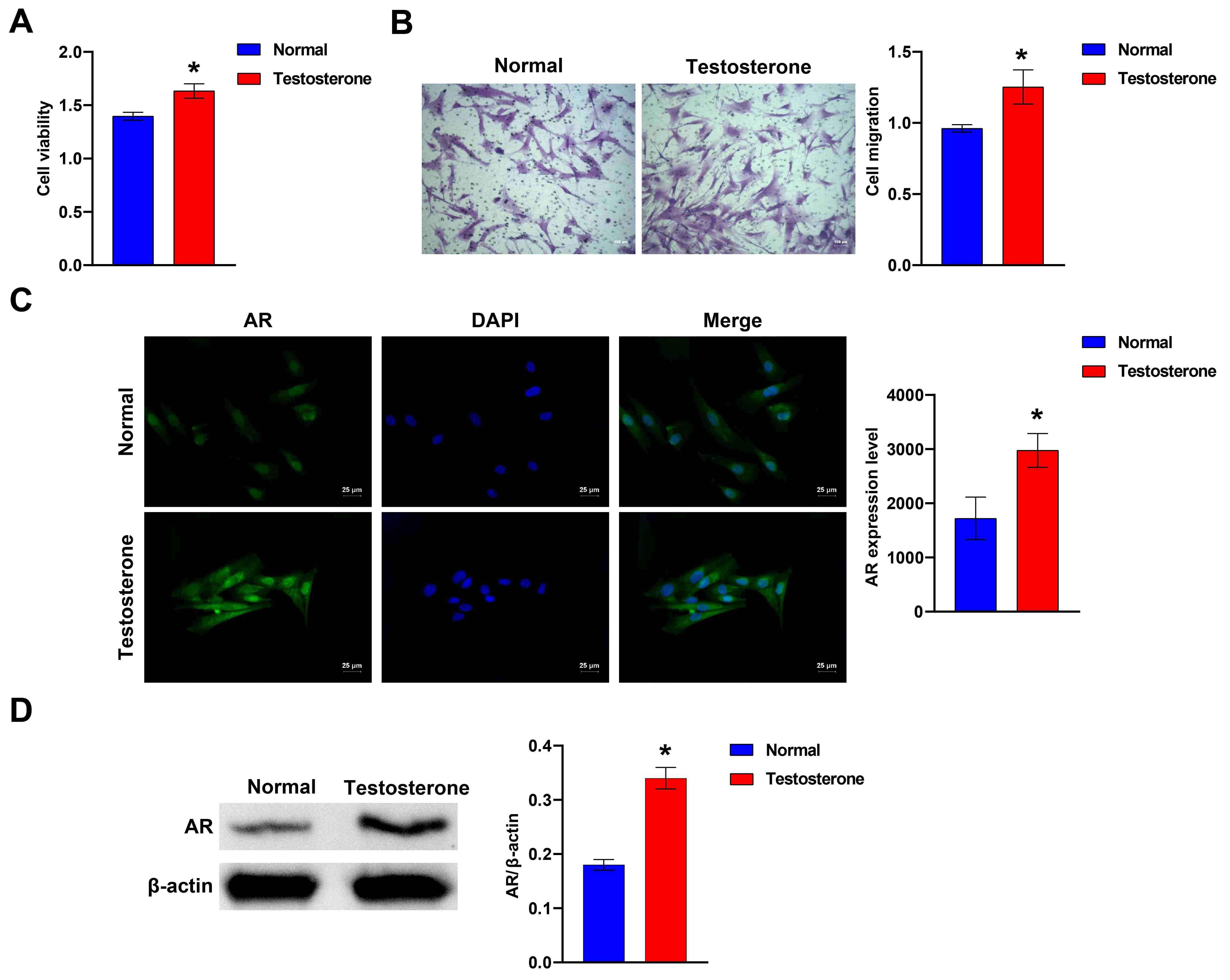 Detection of HFF-1 cell proliferation and migration. (A) CCK8 assays were
used to measure cell viability. (B) Transwell assay for cell migration. Scale bar = 100 µm. (C) The expression of AR was determined by immunofluorescence. Scale bar =
25 µm. (D) The protein abundance of AR was analyzed by western blotting. The student’s t-test
was used to analyze statistical significance. *p < 0.05
vs. Normal group. AR: androgen receptor; DAPI:
4,6-diamidine-2-phenylindole dihydrochloride.