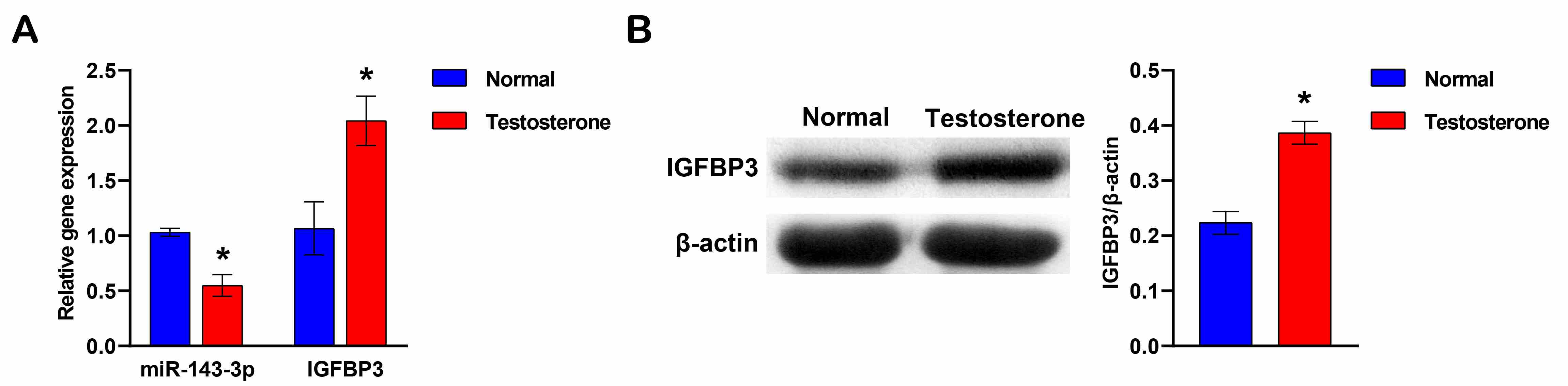 Down-regulation of miR-143-3p and up-regulation IGFBP-3 in HFF-1 cells. (A)
Expression levels of miR-143-3p and IGFBP-3 by qRT-PCR. (B)
Protein abundance of IGFBP-3 by western blotting.
The student’s t-test was used to analyze statistical significance. *p < 0.05 vs. Normal group. IGFBP-3: insulin-like growth factor binding protein-3.