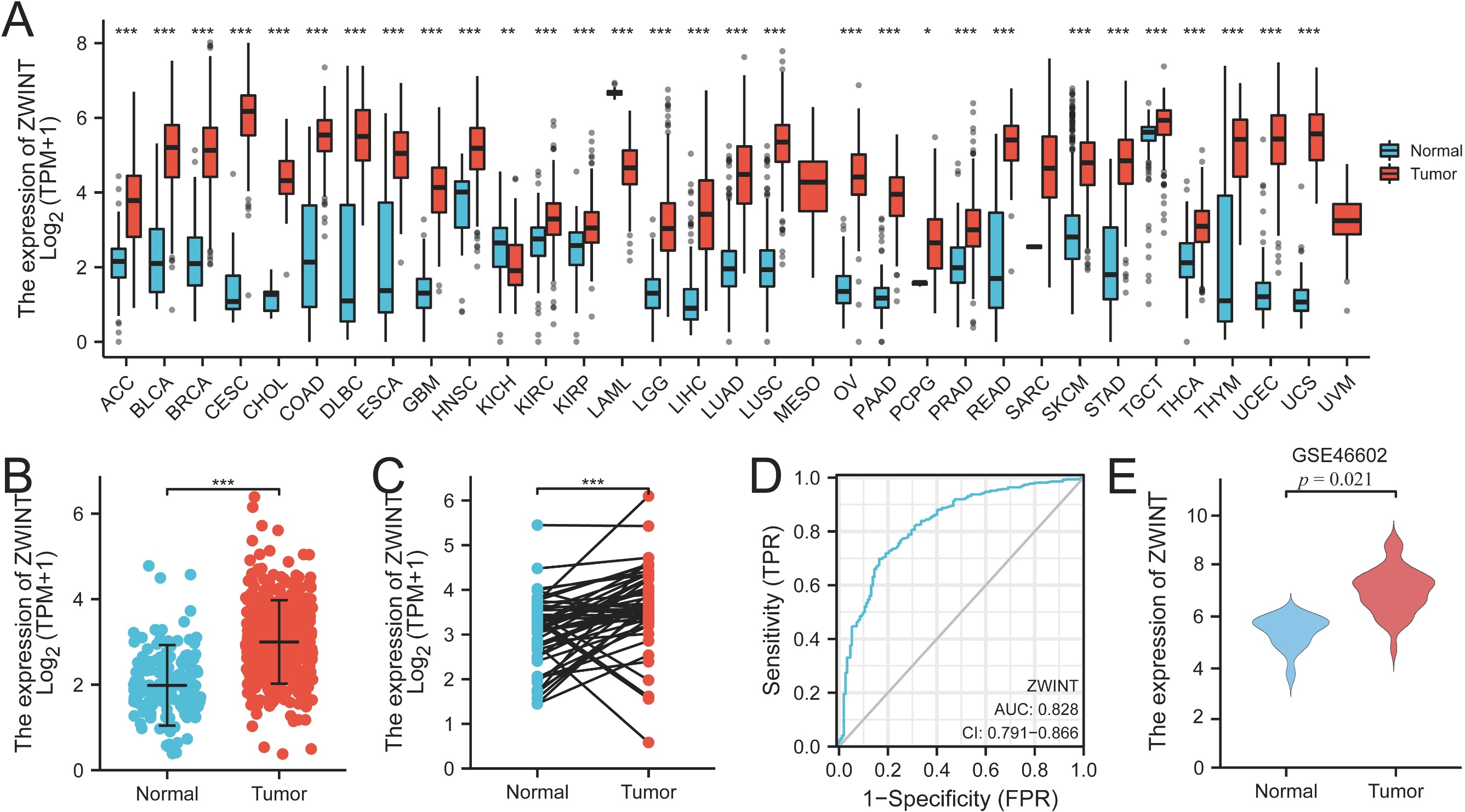 Expression analysis of ZWINT in cancers. (A,B):
Expression of ZWINT in 33 cancers and prostate cancer. (C): Expression
of ZWINT in paired samples of prostate cancer. (D): Sensitivity and
specificity of ZWINT in diagnosing PCa. (E): Expression of
ZWINT in GSE46602 validation set. (* p < 0.05, ** p
< 0.01, *** p < 0.001). ACC: Adrenocortical carcinoma; BLCA:
Bladder urothelial carcinoma; BRCA: Breast invasive carcinoma; CESC:
Cervical squamous cell carcinoma; CHOL: Cholangio carcinoma; COAD: Colon
adenocarcinoma; DLBC: Lymphoid neoplasm diffuse large B-cell lymphoma; ESCA:
Esophageal carcinoma; GBM: Glioblastoma multiforme; HNSC: Head and Neck squamous
cell carcinoma; KICH: Kidney chromophobe; KIRC: Kidney renal clear cell
carcinoma; KIRP: Kidney renal papillary cell carcinoma; LAML: Acute myeloid
leukemia; LGG: Brain lower grade glioma; LIHC: Liver hepatocellular carcinoma;
LUAD: Lung adenocarcinoma; LUSC: Lung squamous cell carcinoma; MESO:
Mesothelioma; OV: Ovarian serous cystadenocarcinoma; PAAD: Pancreatic
adenocarcinoma; PCPG: Pheochromocytoma and Paraganglioma; PRAD: Prostate
adenocarcinoma; READ: Rectum adenocarcinoma; SARC: Sarcoma; SKCM: Skin cutaneous
melanoma; STAD: Stomach adenocarcinoma; TGCT: Testicular germ cell tumors; THCA:
Thyroid carcinoma; THYM: Thymoma; UCEC: Uterine corpus endometrial carcinoma;
UCS: Uterine carcinosarcoma; UVN: Uveal melanoma; TPM: Transcripts per million;
ZWINT: ZW10 Interactor; TPR: True Positive Rate; FPR: False
Positive Rate.