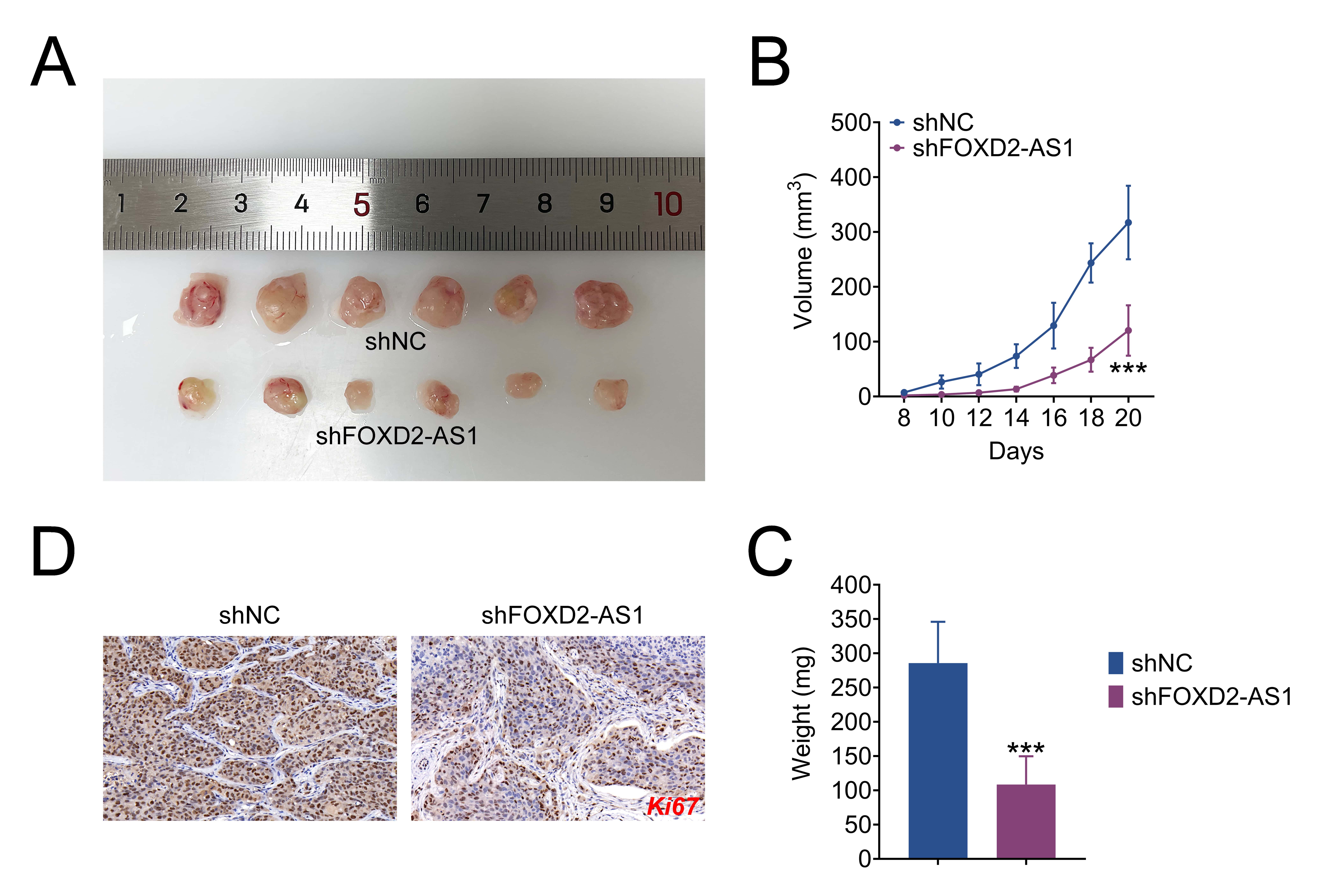 FOXD2-AS1 silencing suppressed the development of prostate 
cancer in vivo. (A) The picture of tumor tissues in each group. (B) 
The size of the tumor in nude mice that 
received injections of PCa cells transfected with shNC and shFOXD2-AS1. (C) 
The tumor weight was observed in nude mice 
that were injected with PCa cells transfected with both shNC and shFOXD2-AS1. (D) 
The proliferation (shown in Ki67) of tumors was analyzed by immunohistochemistry. 
The results are expressed as the mean ± SD. ***p < 0.001 vs. shNC. FOXD2-AS1: FOXD2 
Adjacent Opposite Strand RNA 1. ShNC: sh-Numerical Control.