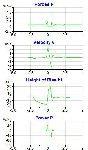 Schematic diagram of the SJ test index.