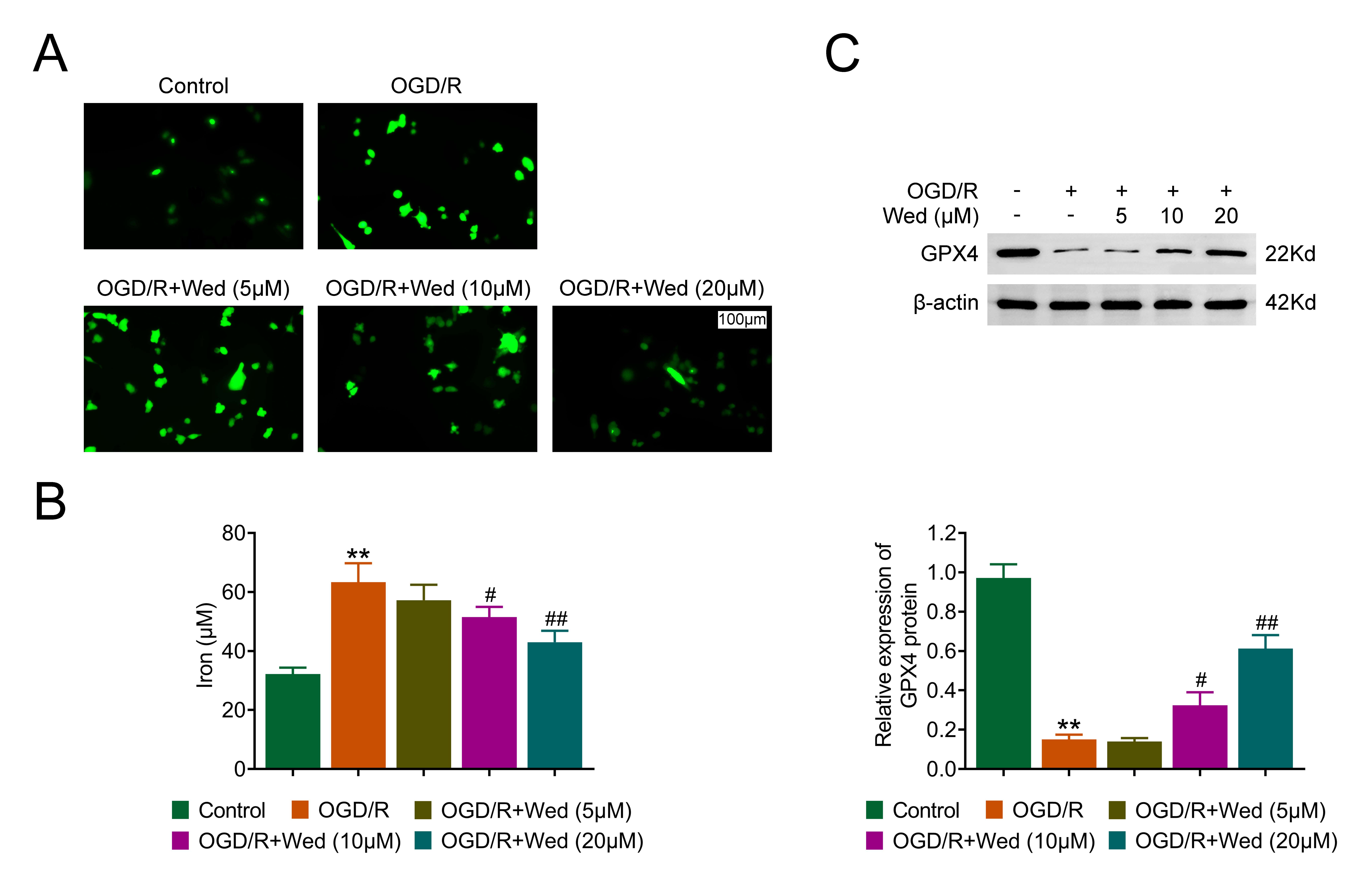 Wedelactone alleviates OGD/R-induced ferroptosis. (A) DCF
staining illustrating ROS levels in HT-22 cells under OGD/R treatment and
Wedelactone treatment (5, 10 and 20 µM). (B) Iron detection kit
measurements of iron release in HT-22 cells under OGD/R treatment and Wedelactone
treatment (5, 10 and 20 µM). (C) Immunoblot showing GPX4 expression in
HT-22 cells under OGD/R treatment and Wedelactone treatment (5, 10 and 20
µM). Error bars represent SD. **p < 0.01, OGD/R
vs. control, #p < 0.05, ##p < 0.01, OGD/R +
Wedelactone vs. OGD/R. OGD/R: oxygen-glucose deprivation/reperfusion;
GPX4: Glutathione peroxidase 4.