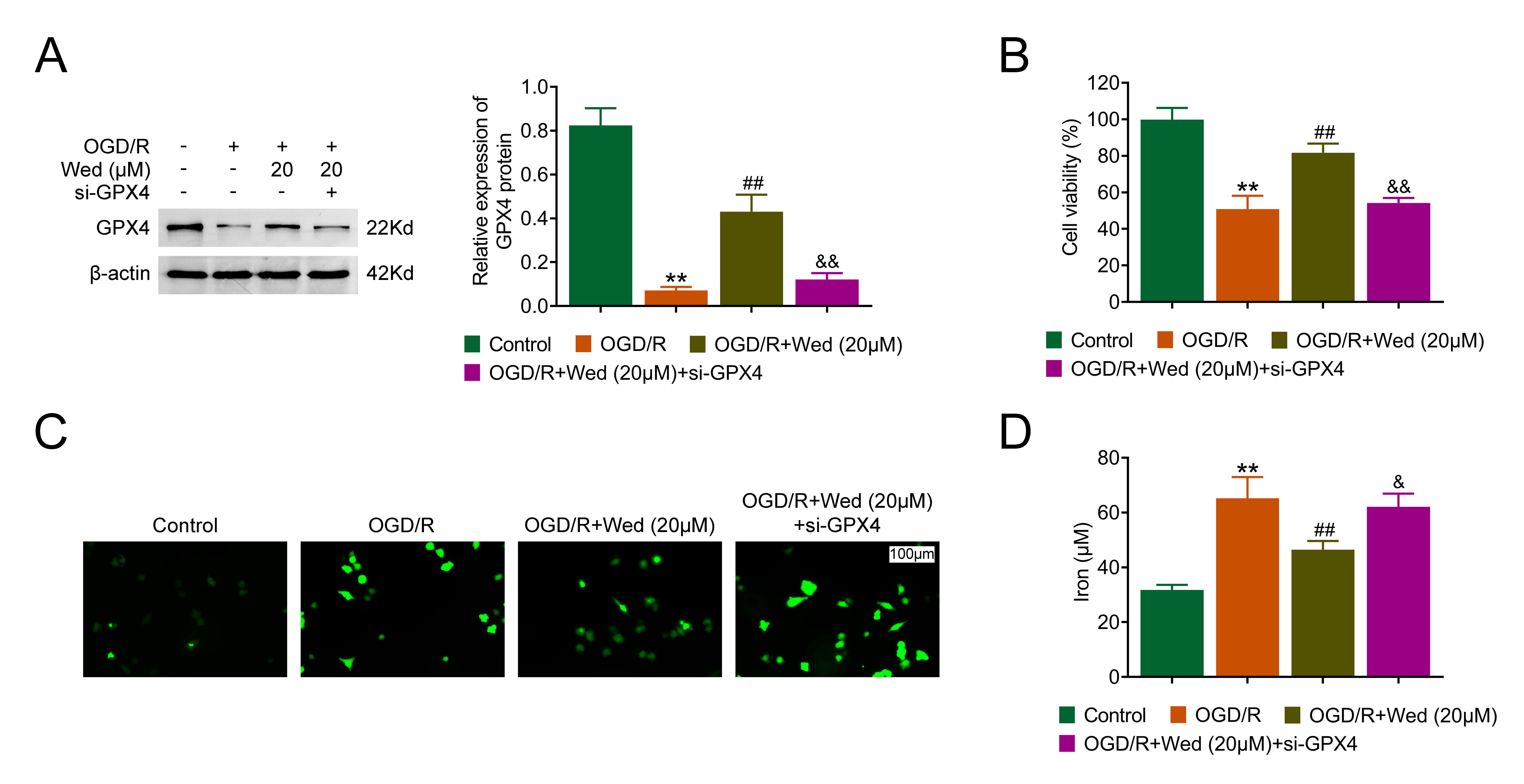 Wedelactone inhibits OGD/R-stimulated ferroptosis by regulating
GPX4 expression. (A) Immunoblot assays showing GPX4 expression in HT-22 cells
under the indicated treatment. (B) CCK-8 assays assessing HT-22 cell viability
under the indicated treatment, with OD450 values measured. (C) DCF staining
indicating ROS levels in HT-22 cells under the indicated treatment. (D) DCF
staining displaying ROS levels in HT-22 cells under the indicated treatment.
Error bars represent SD. **p < 0.01, OGD/R vs.
control, ##p < 0.01, OGD/R + Wedelactone vs. OGD/R,
&p < 0.05, &&p < 0.01, OGD/R + Wedelactone + siGPX4
vs. OGD/R + Wedelactone + siNC. NC: negative control; OGD/R:
oxygen-glucose deprivation/reperfusion; GPX4: Glutathione peroxidase 4.