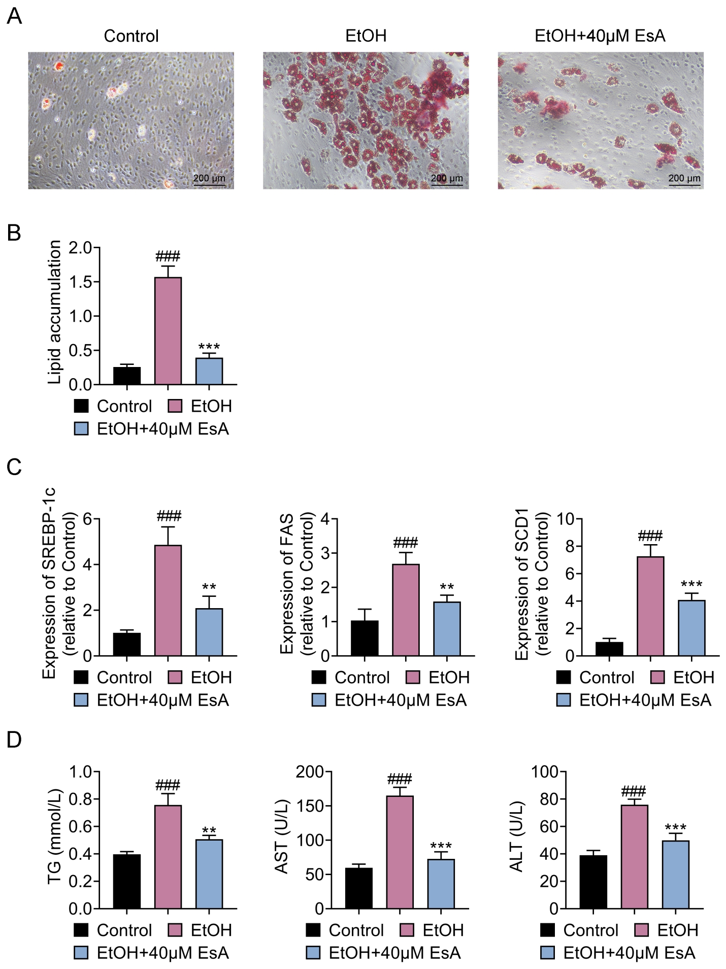 EsA hinders EtOH-tempted lipid 
accumulation in hepatocytes. (A) Oil red O (ORO) staining (scale bar = 200 
μm). The lipid accumulation of AML-12 cells was determined by ORO staining. 
(B) Analysis of lipid accumulation in AML-12 cells. (C) The levels of SREBP-1c, 
FAS and SCD1 were determined by qRT-PCR. (D) The TG, AST and ALT contents in 
AML-12 cells were measured by corresponding commercial kits. ###p < 0.001 versus the control group; **p < 0.01 and ***p < 
0.001 with respect to the control group EtOH group. EtOH: ethanol; EsA: 
Esculentoside A; TG: triglycerides; AST: aspartate aminotransferase; ALT: alanine 
aminotransferase; SREBP-1c: sterol regulatory element-binding 
protein-1c; FAS: fas cell surface death receptor; SCD1: 
stearoyl-Coenzyme A desaturase 1.