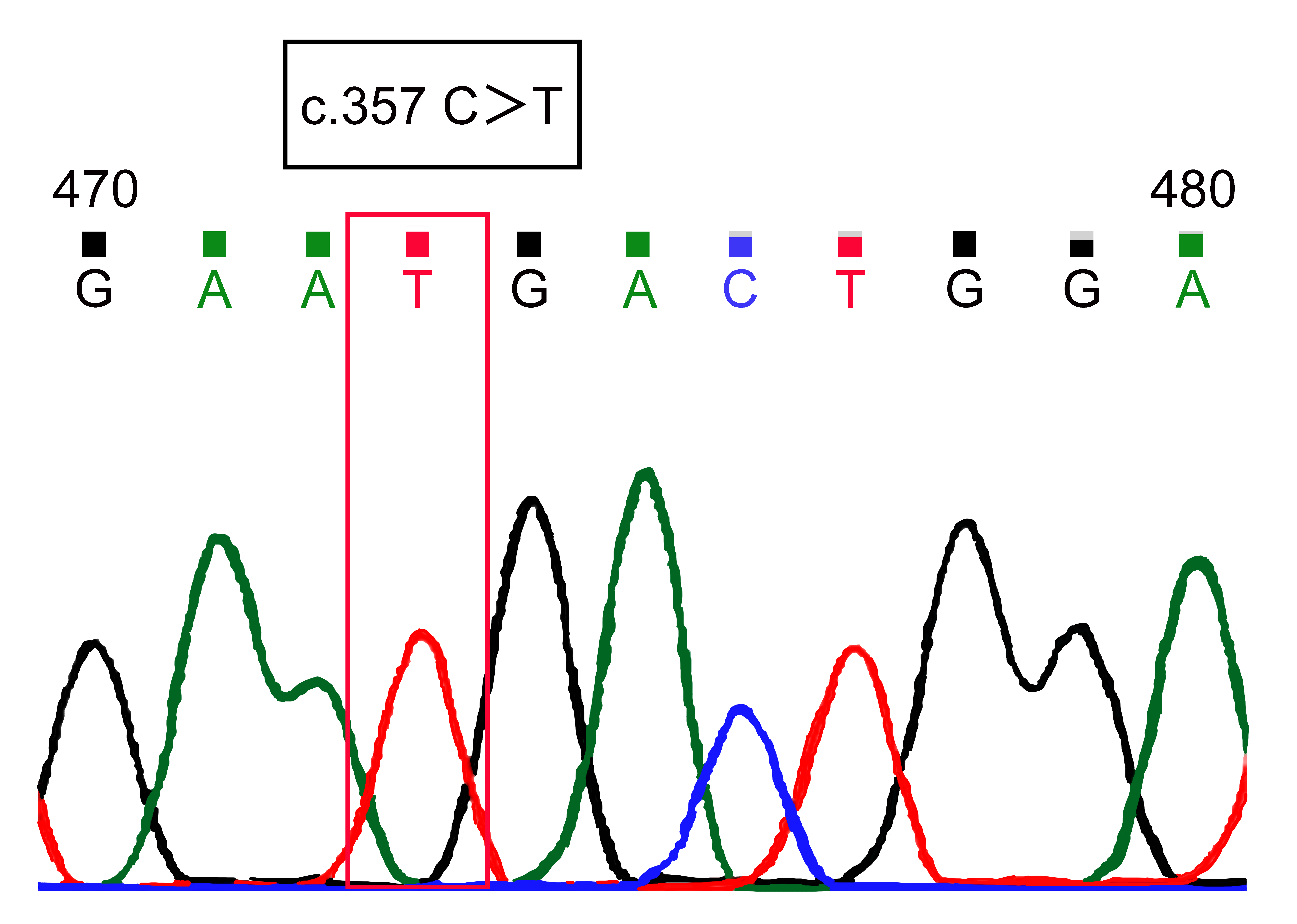 Direct sequencing revealed a homozygous variant in the
FUT 2 gene c.357C>T.