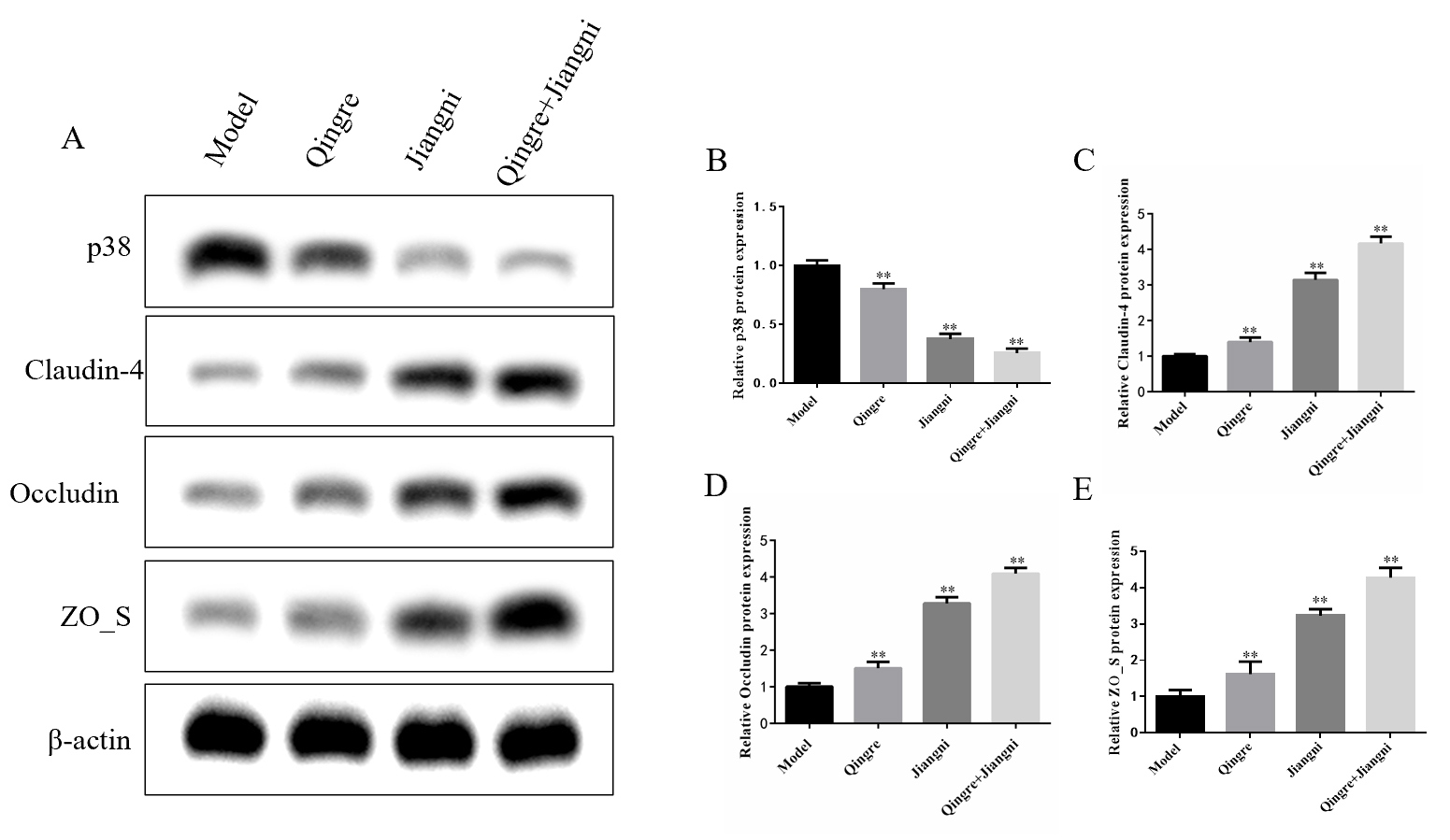 Western blotting (A) to detect (B) p38, (C) claudin-4, (D)
occludin, and (E) ZO_S. **p < 0.01 compared with the model group.
ZO_S: Zonula Occludens.