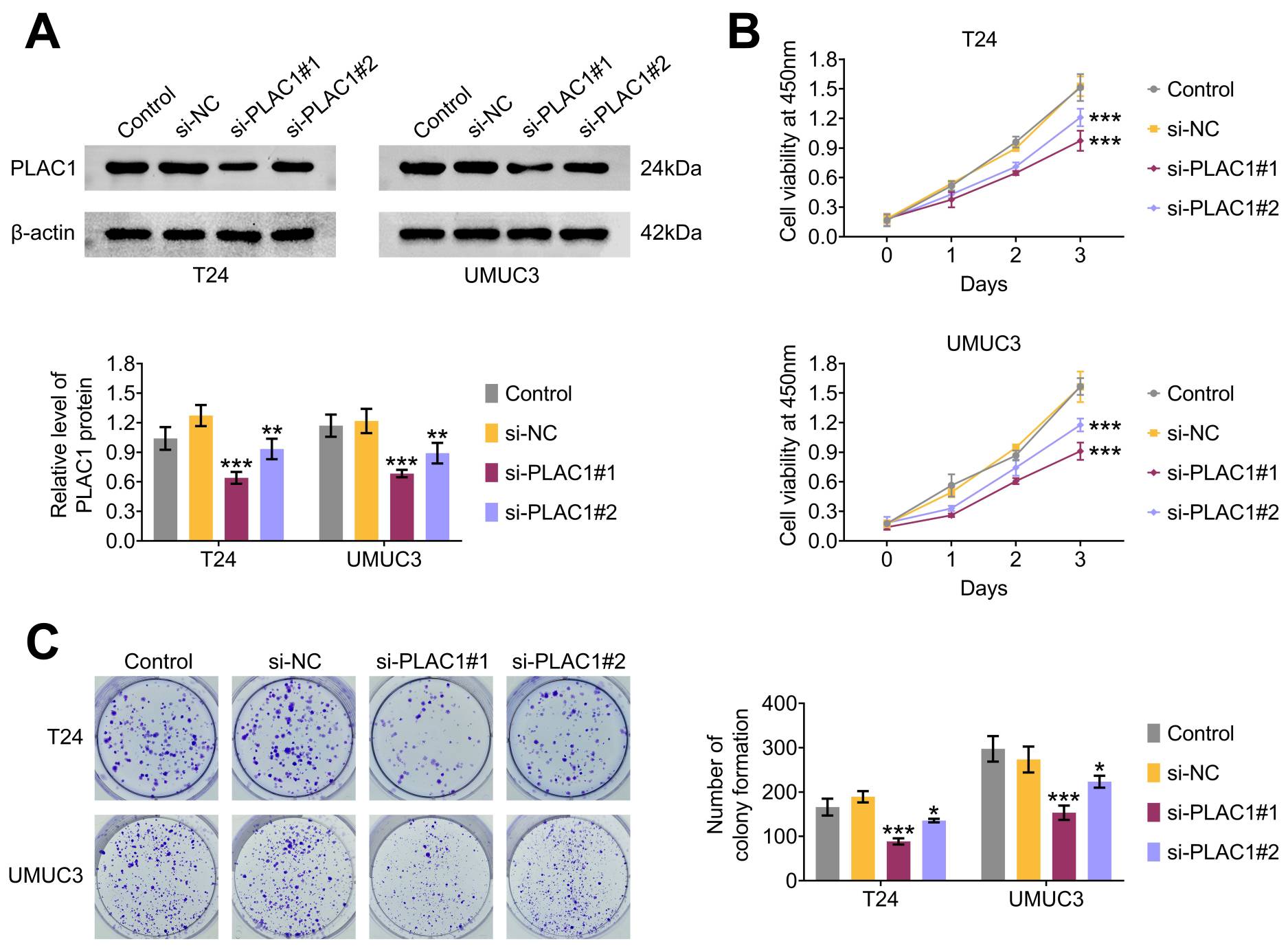 Impact of PLAC1 knockdown on viability and proliferation in T24
and UMUC3 cells. (A) Immunoblot analysis revealing PLAC1 expression levels in T24
and UMUC3 cells after transfections. (B) CCK-8 assays illustrating the viability
of T24 and UMUC3 cells at 0, 24h, 48h and 72h post-transfection. OD values were
detected at 450 nm via CCK-8 assays. (C) Colony formation assay
demonstrating the proliferation ability of T24 and UMUC3 cells after the
indicated transfections. *p < 0.05, **p < 0.01,
***p < 0.001, siPLAC1 vs. siNC (n = 3). NC: negative control;
PLAC1: Placenta-specific protein 1.