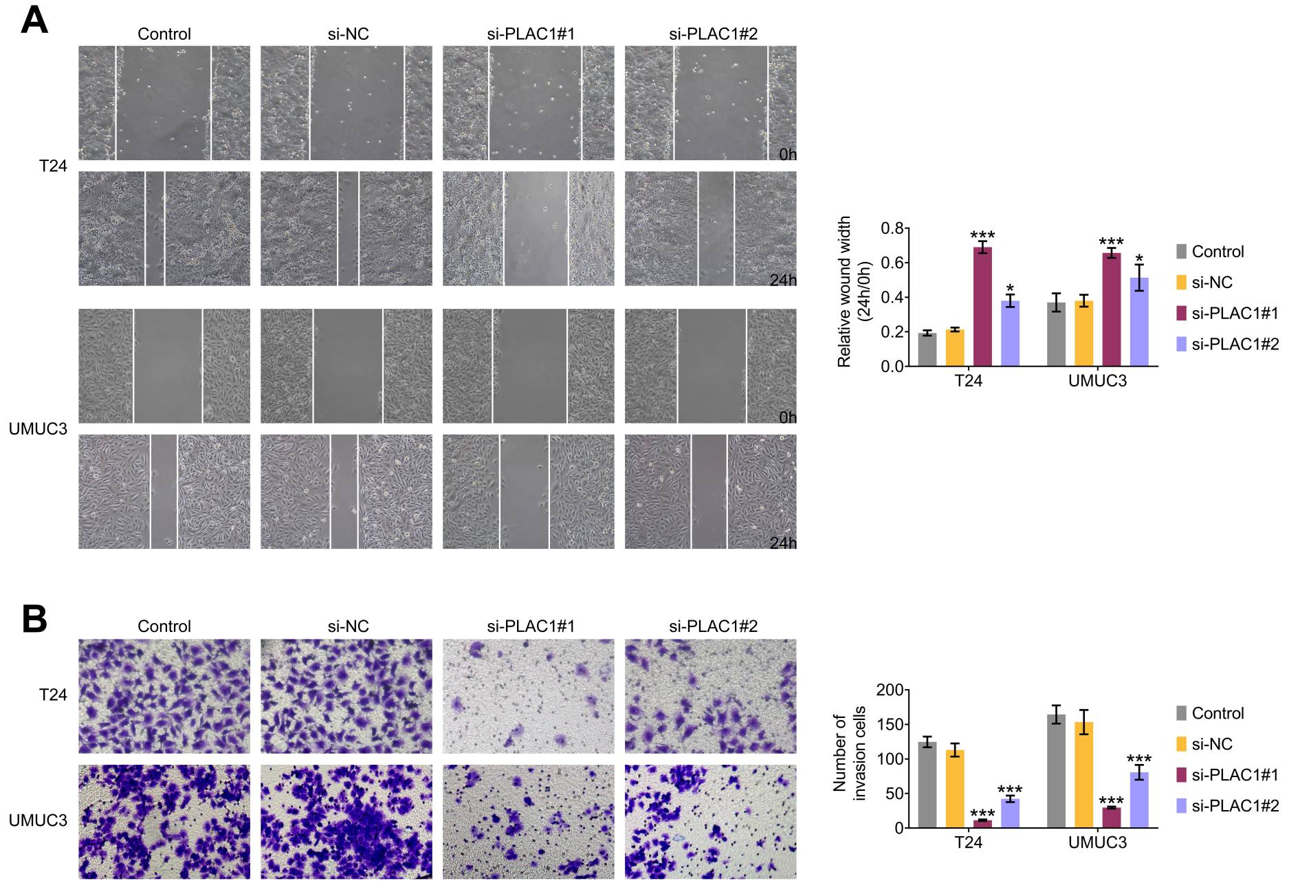Significance of PLAC1 knockdown on the migration and invasion of
BCa cells. (A) Wound healing assay confirming the effect of PLAC1 on the
migration of T24 and UMUC3 cells. (B) Transwell assay demonstrating the influence
of PLAC1 on the migration of T24 and UMUC3 cells. Cells that migrated to the
lower chamber of the filter after 24 hours of incubation were stained and counted
under an optical microscope. *p < 0.05, ***p < 0.001,
siPLAC1 vs. siNC (n = 3). NC: negative control; PLAC1: Placenta-specific
protein 1.