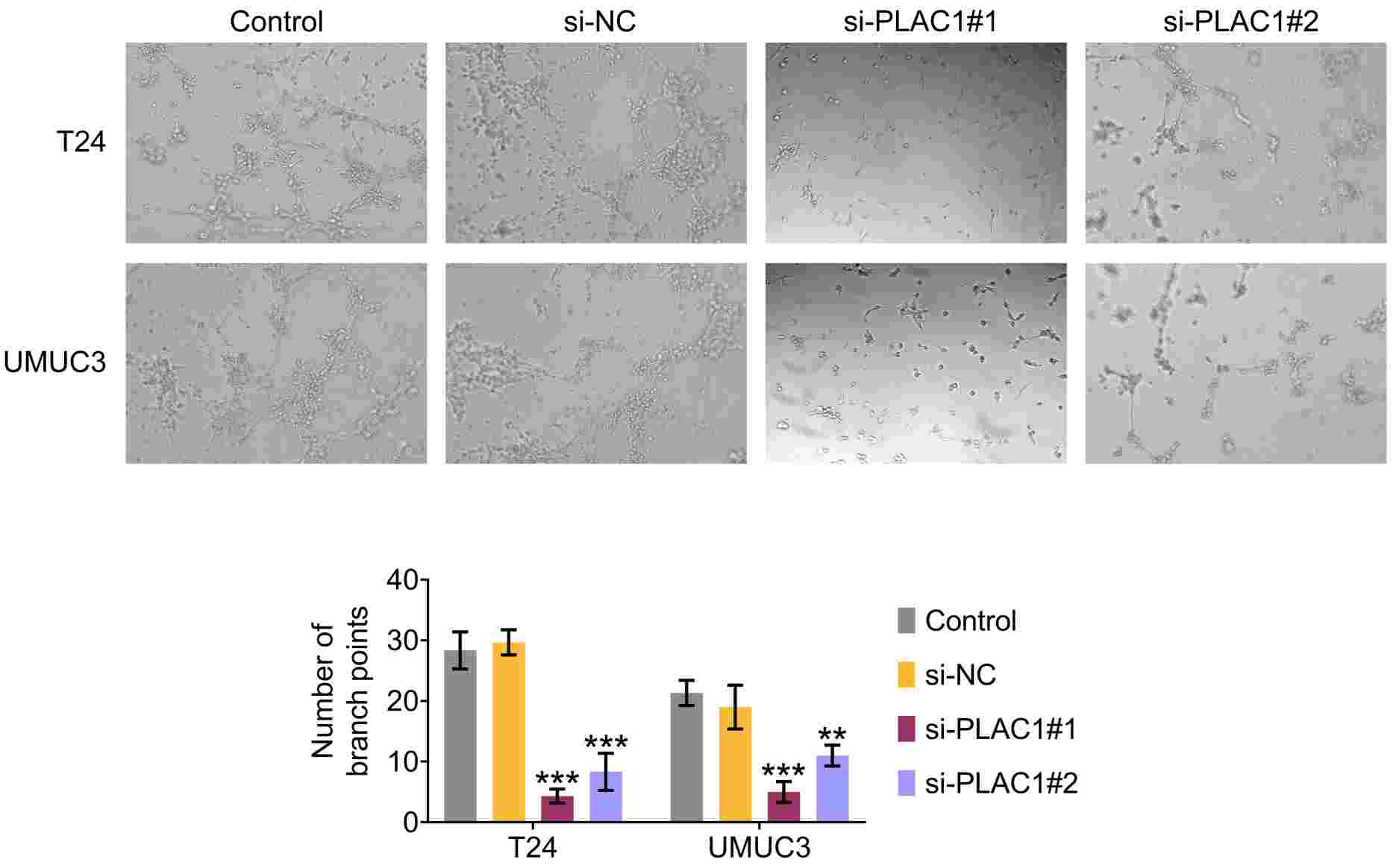 Effects of PLAC1 knockdown in BCa cells on HUVECs angiogenesis.
The tube formation ability of HUVECs was assessed after 6 hours of cultivation in
the tumor-conditioned media (TCMs) from the indicated groups using tube formation
assays, and the number of branch points in each field was counted. **p < 0.01, ***p < 0.001, siPLAC1 vs. siNC. NC: negative
control; PLAC1: Placenta-specific protein 1.