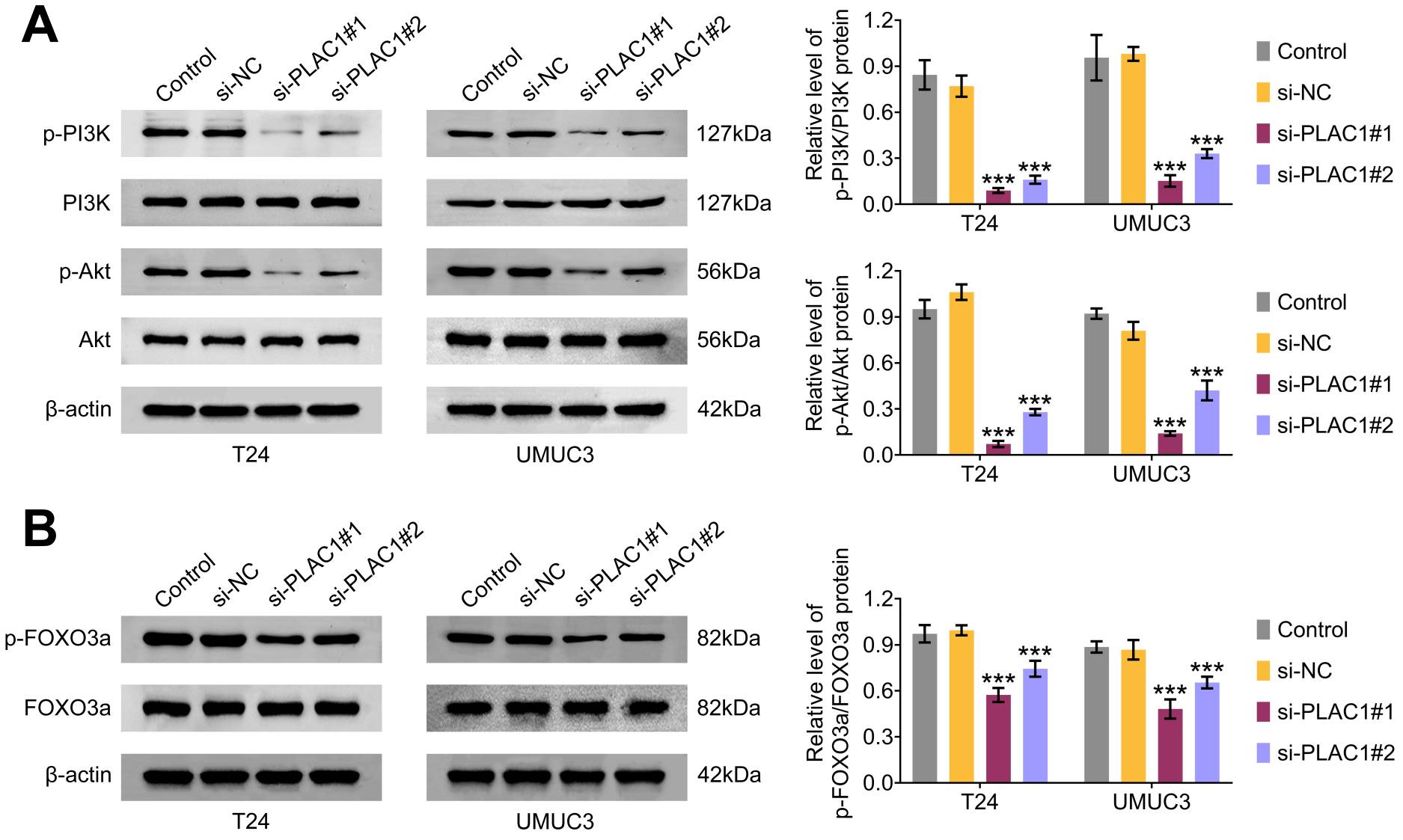 Suppression of the PI3K/Akt/FOXO3a pathway by PLAC1 in BCa
cells. Immunoblot analysis of the expression and phosphorylation levels of PI3K,
Akt and FOXO3a in T24 and UMUC3 cells following transfection with the indicated
siRNAs. ***p < 0.001, siPLAC1 vs. siNC. NC: negative control;
PLAC1: Placenta-specific protein 1; PI3K: phosphoinositide 3-kinase; Akt: protein
kinase B; FOXO3a: forkhead box O3a.