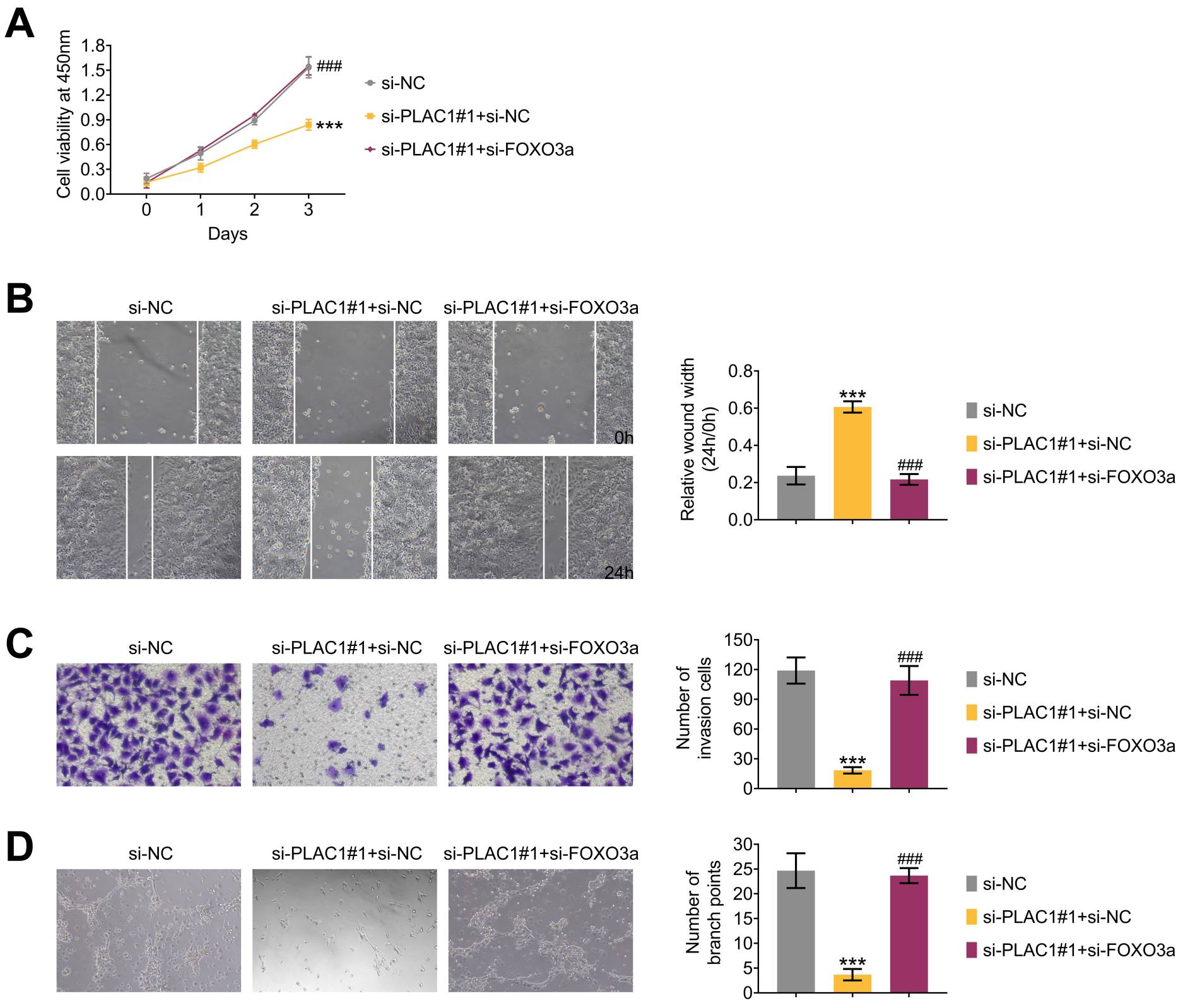Knockdown of PLAC1 inhibits BCa progression through FOXO3a. (A)
Viability of T24 cells following the indicated transfections assessed by CCK-8
assays. (B) Migration of T24 cells upon the indicated transfections evaluated by
wound healing assay. (C) Migration of T24 cells following the indicated
transfections confirmed by transwell assay. (D) Tube formation ability of HUVECs
cultivated for 6 hours in the tumor-conditioned media (TCMs) from the indicated
groups assessed through tube formation assays. ***p < 0.001 siPLAC1
vs. siNC, ###p < 0.001 siPLAC1 + siFOXO3a vs.
siPLAC1 (n = 3). NC: negative control; PLAC1: Placenta-specific protein 1; PI3K:
phosphoinositide 3-kinase; FOXO3a: forkhead box O3a.