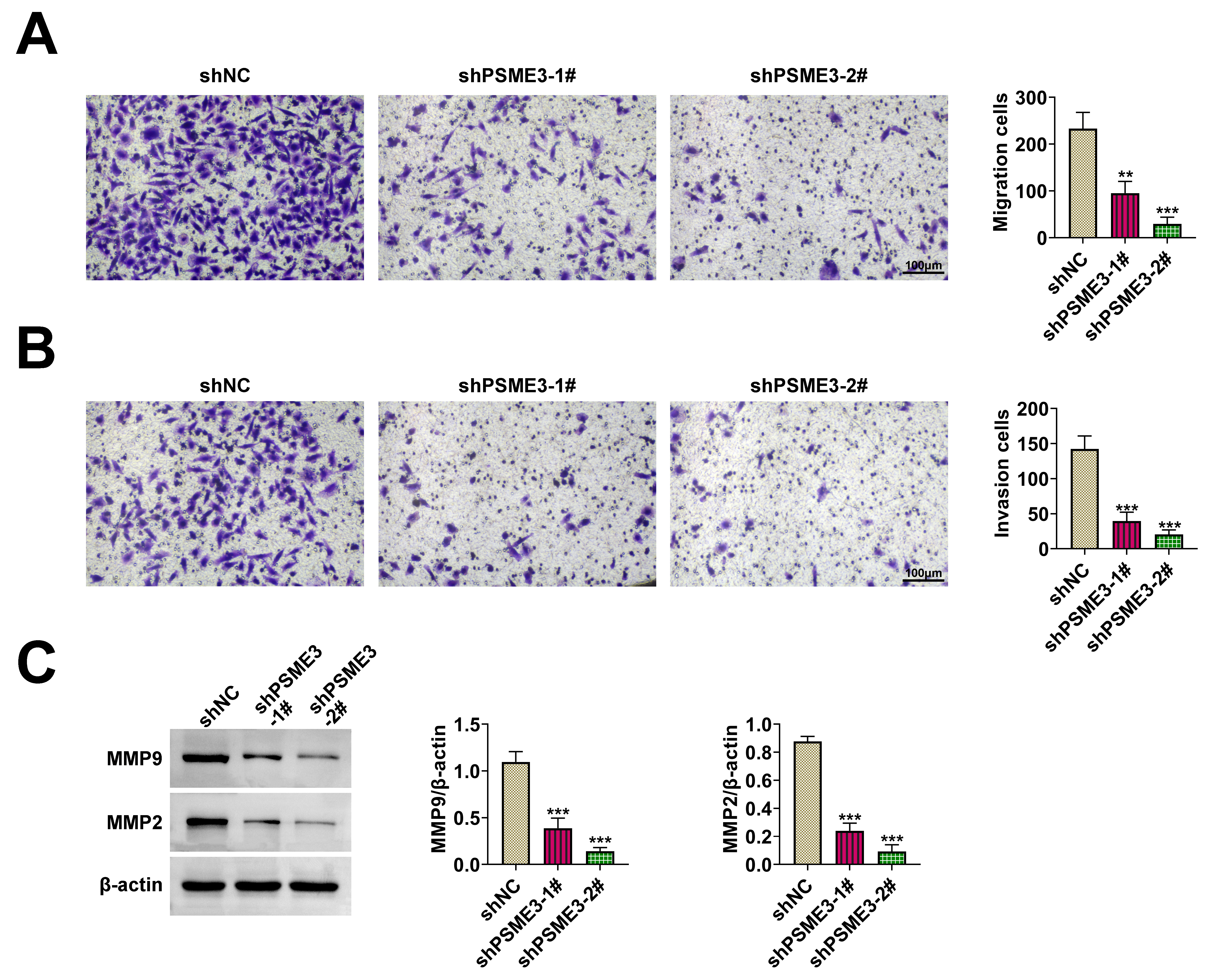 PSME3 facilitated cell migration in 
GC. (A) Cell migration ability was evaluated after PSME3 silencing through 
Transwell assay. (B) Cell invasion ability was tested after PSME3 
inhibition through Transwell assay. (C) MMP9 and MMP2 protein expressions were 
examined after PSME3 suppression through western blot. **p < 0.01, ***p < 0.001. PSME3: Proteasome activator subunit 3; shNC: 
short hairpin RNA negative control; MMP: 
Matrix Metalloproteinase.