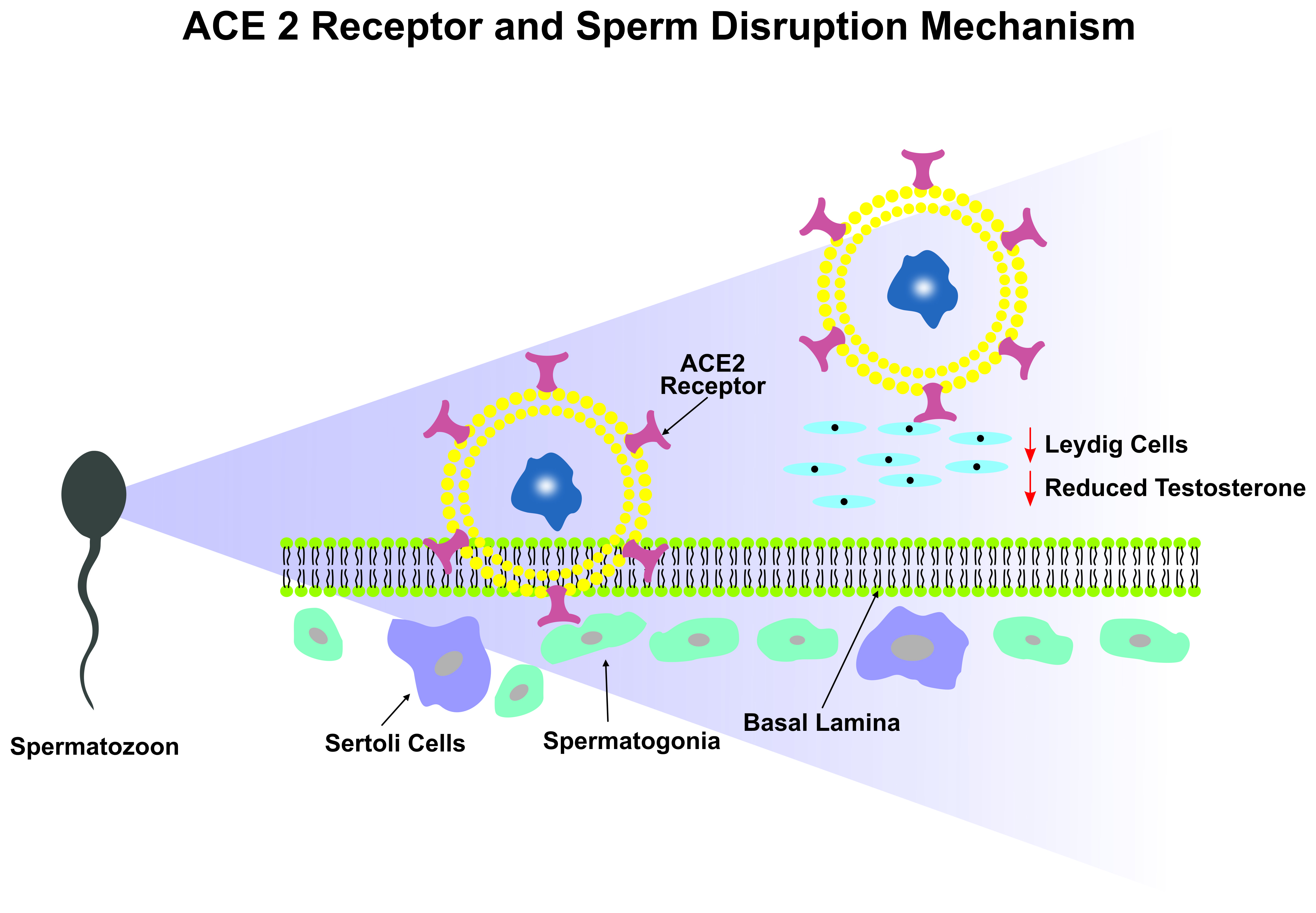 ACE-2 receptor and sperm disruption mechanism: this illustrative 
depiction provides a comprehensive overview of the intricate ACE-2 receptor and 
sperm disruption mechanism, particularly in the context of SARS-CoV-2 viral 
infections in males, with a specific emphasis on the impact on human Leydig 
cells. The image showcases the distribution of ACE-2 receptors on the surface of 
cells within the male testes. These receptors, known for their role in regulating 
blood pressure and inflammation, have been identified as potential targets for 
viral entry, including by certain coronaviruses. A depiction of a viral particle, 
possibly a coronavirus, approaching and binding to the ACE-2 receptor on the 
surface of a sperm cell is highlighted. The interaction between the viral spike 
protein and the ACE-2 receptor is a critical step for the virus to gain entry 
into the host cell. Upon binding, the viral particle is internalized into the 
sperm cell through endocytosis. This internalization triggers a cascade of events 
within the sperm, potentially leading to disruptions in its normal functioning. 
The image could show the release of viral genetic material into the sperm cell or 
the interference with essential cellular processes [28]. ACE2: angiotensin-converting enzyme 2.