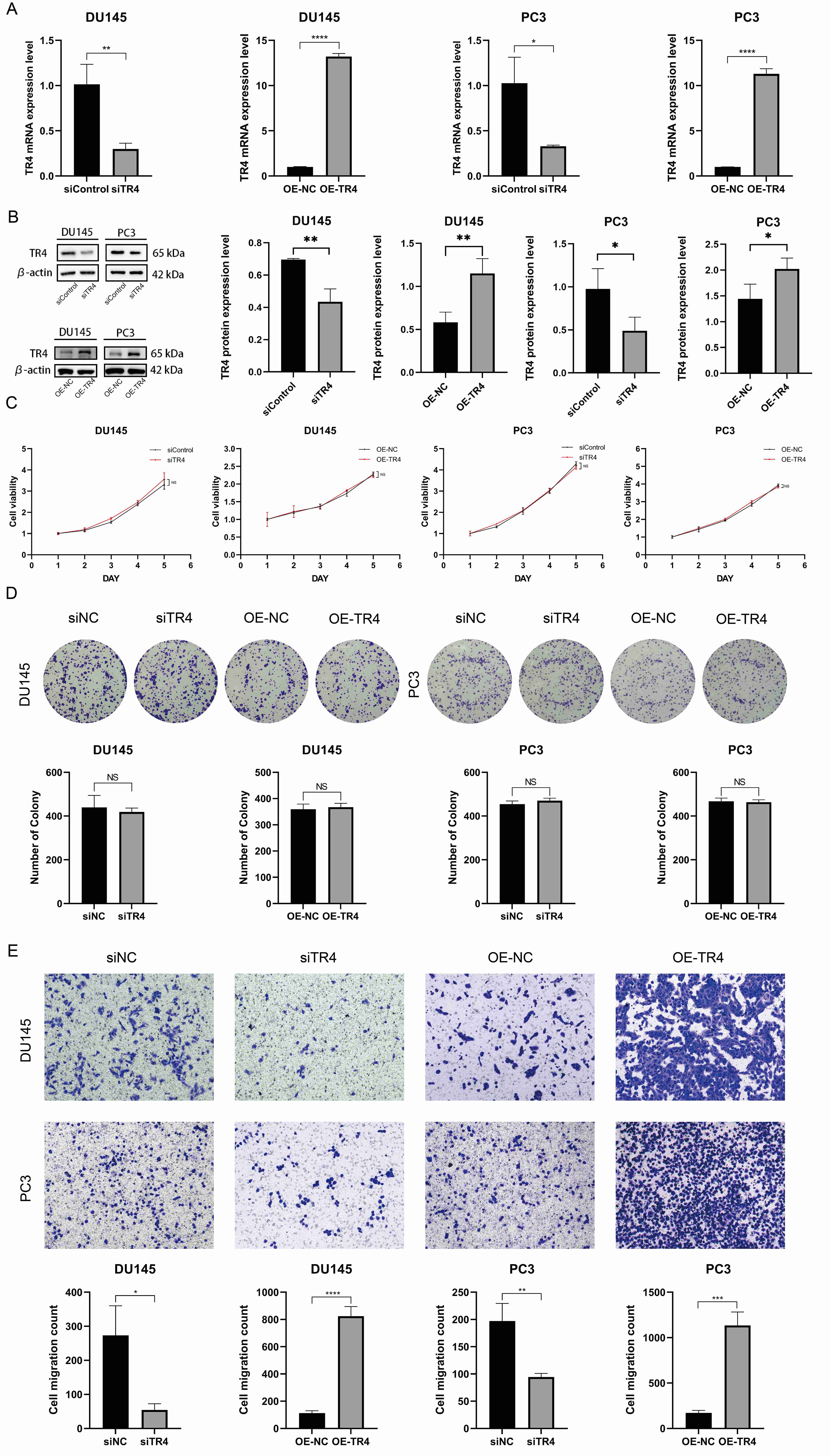 Modulation of TR4 expression and its impact on prostate
cancer cell migration and proliferation. (A,B) Examination of changes in
TR4 levels in DU145 and PC3 cells at the mRNA and protein levels. (C)
Results of continuous 5-day CCK-8 experiments to assess changes in cell viability
after targeting changes in TR4 levels in DU145 and PC3 cells. (D)
Results of the colony formation assay after adjusting TR4 levels in PC
cell lines and cultivating for two weeks. (E) The effect of TR4
targeting changes on DU145 and PC3 cell migration. Cells were incubated in
transwell inserts for 24 hours (DU145) and 48 hours (PC3). siNC/siControl,
siRNA-negative control; siTR4, siRNA-TR4; OE-NC, overexpression-negative control;
OE-TR4, overexpression-TR4; OLA, olaparib; NS, for no statistical significance;
*p < 0.05; **p < 0.01; ***p < 0.001;
****p < 0.0001.
