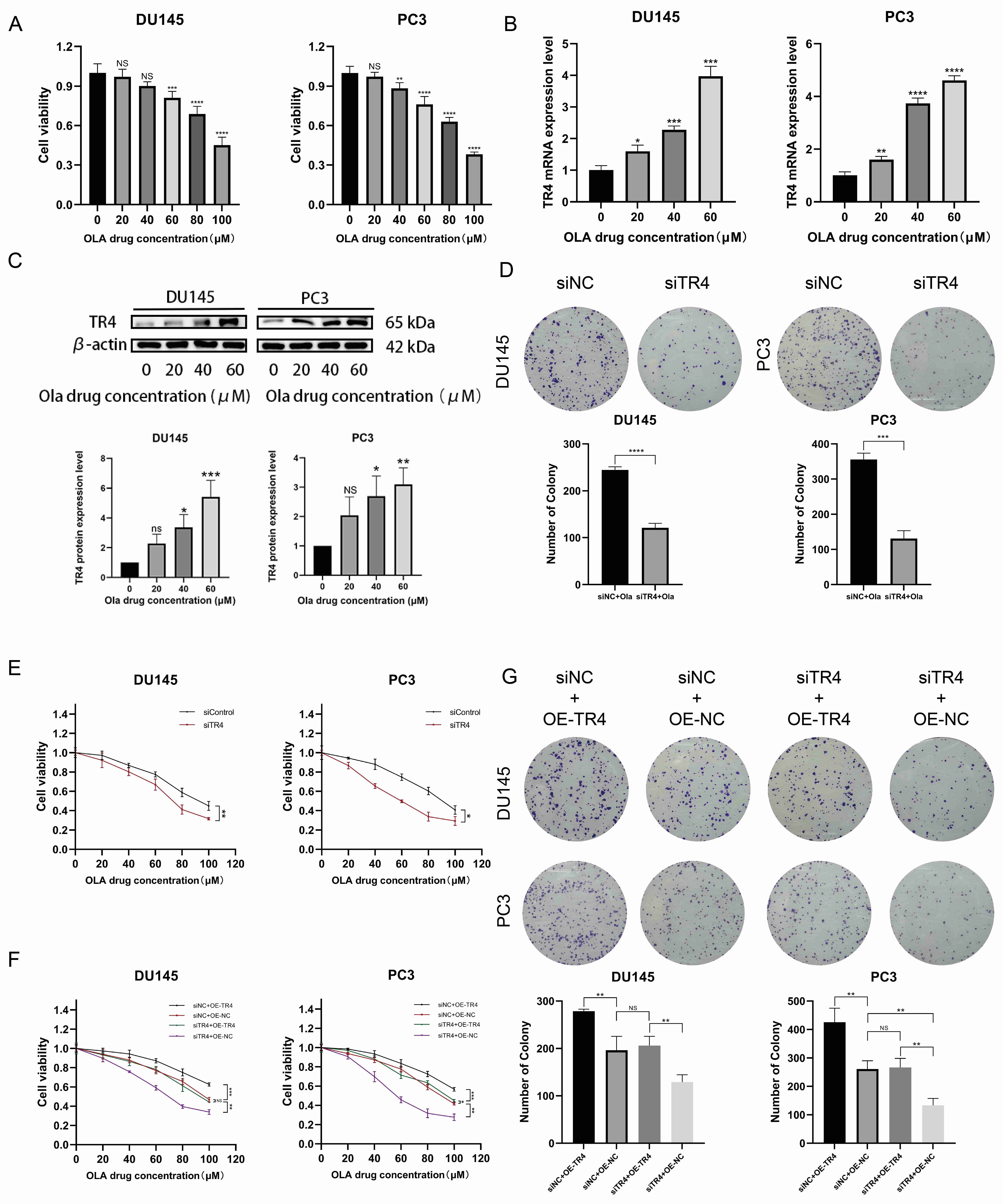 Correlation of TR4 expression with in vitro
sensitivity to olaparib in PC cell lines. (A) Viability of DU145 and PC3 cells
treated with olaparib (0–100 µM) for 48 hours using CCK-8 reagent. (B,C)
TR4 expression was measured at mRNA and protein levels in DU145 and PC3 cells
cultured in media containing varying concentrations of olaparib (0–60 µM).
(D) Silencing the TR4 gene and treating PC cell lines with 40 µM olaparib
resulted in changes in proliferative capacity. The colony formation assays were
incubated continuously for two weeks. (E) CCK-8 assay to determine changes in
cell sensitivity to olaparib gradient concentrations after silencing the
TR4 gene in PC cell lines. (F) After two days of treatment with olaparib
at a gradient concentration, sensitivity to olaparib in cell lines that
re-overexpressed TR4 following TR4 knockdown returned to normal
levels as detected by the CCK-8 assay. (G) After 2 weeks of treatment with 40
µM olaparib, colony formation assay revealed that proliferative capacity
returned to normal levels in PC cell lines re-overexpressed TR4
following TR4 knockdown. siNC/siControl, siRNA-negative control; siTR4,
siRNA-TR4; OE-NC, overexpression-negative control; OE-TR4, overexpression-TR4;
OLA, olaparib; NS, for no statistical significance; *p <
0.05; **p < 0.01; ***p < 0.001;
****p < 0.0001.