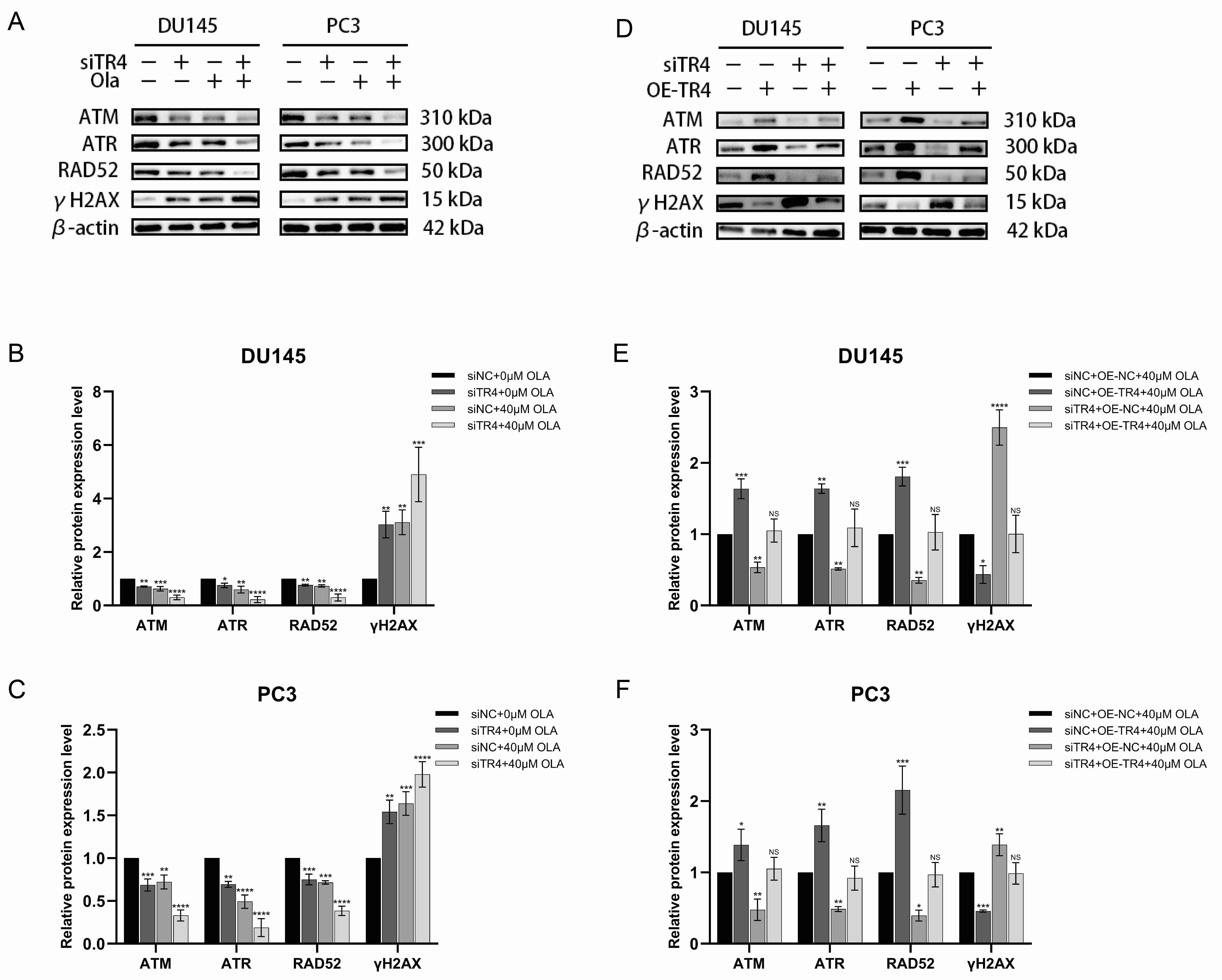 TR4 knockdown increases the in vitro
sensitivity of PC cell lines to PARP inhibition by down-regulating the
ATM/ATR pathway. (A) Western blot bands of the expression
levels of γH2AX, ATM, ATR and RAD52 in DU145 and PC3 cell lines after a
single treatment with 40 µM olaparib, TR4 knockdown or combined
treatment. (B,C) Statistical analysis of the gray values of the western blot
bands in Fig. A. (D) Western blot bands of the related protein expression levels
in TR4-knockdown PC cell lines re-expressing TR4 and treated with 40 µM
olaparib. (E,F) Statistical analysis of the gray values of the western blot bands
in Fig. D. siTR4, siRNA-TR4; OE-TR4, overexpression-TR4; OLA, olaparib; NS, for
no statistical significance; *p < 0.05; **p < 0.01; ***p < 0.001; ****p < 0.0001.