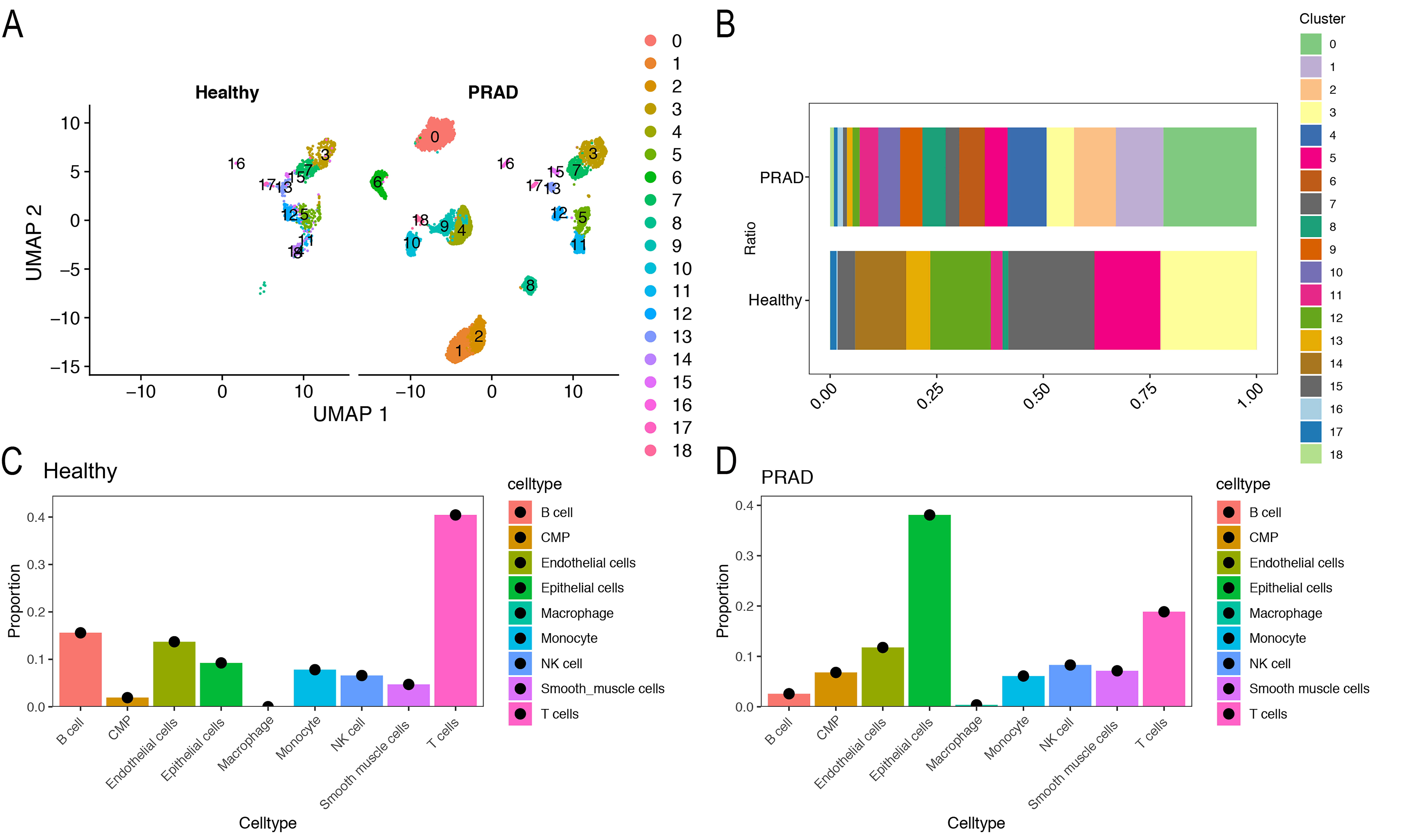 Epithelial cell-related clustering analysis. (A) t-SNE plot
showing the clustering of epithelial cells. (B) Secondary dimensionality reduction
clustering of epithelial cells showing 19 epithelial cell-related clusters. (C)
Comparison of the proportion of epithelial cell-related clusters between healthy
and cancerous tissues. (D) Proportions of epithelial cell-related clusters in
healthy and PRAD tissues. NK cells: natural killer cells; CMP: common-myeloid
progenitors; PRAD: prostate cancer.