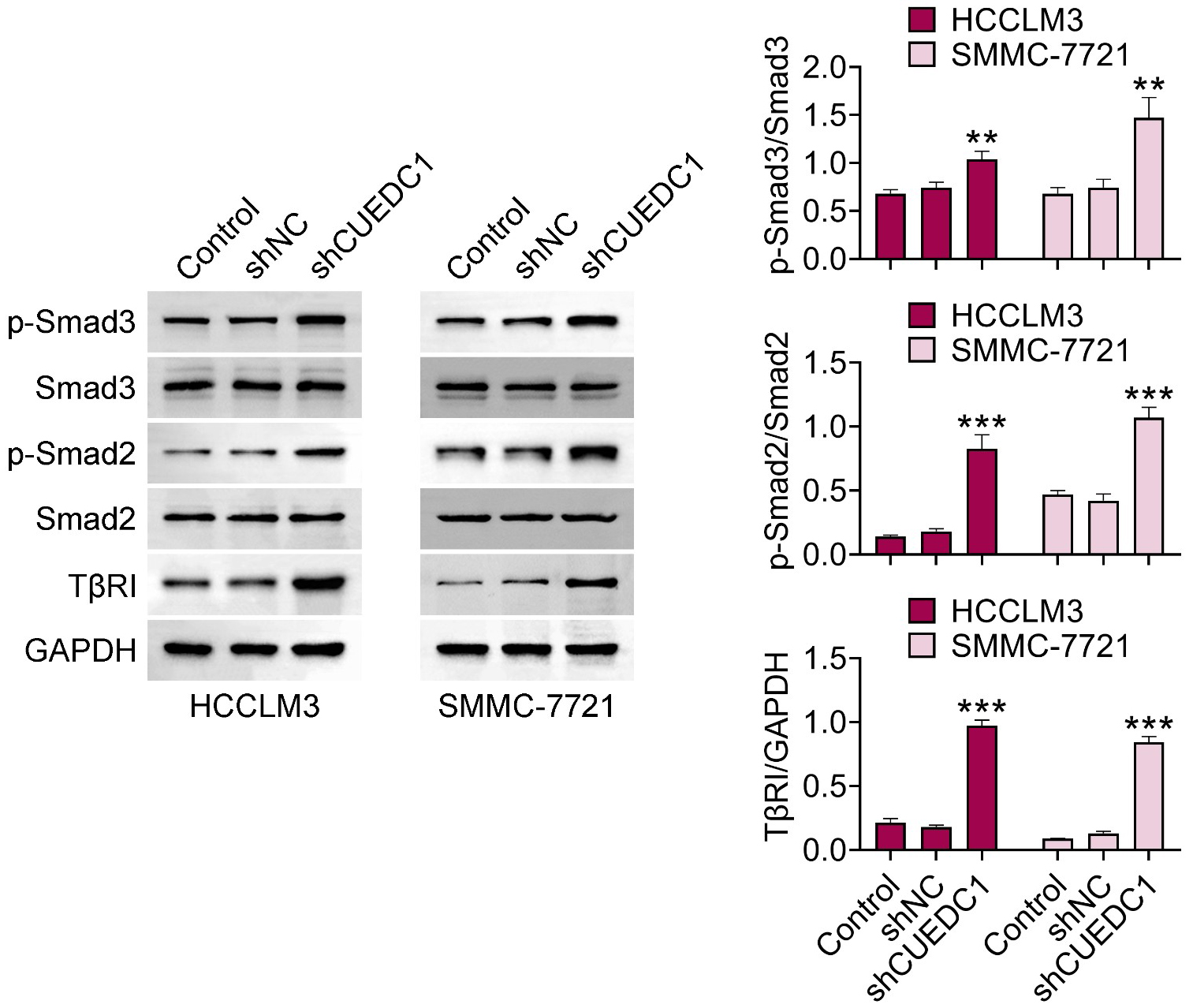 Knockdown of CUEDC1 activated the TβRI/Smad 
signaling pathway. Groups were divided into Control, shNC, and shCUEDC1 groups. 
Protein expressions of p-Smad3, Smad3, 
p-Smad2, Smad2, and TβRI were examined through western 
blot. Statistical significance: **p < 0.01, ***p < 0.001. 
CUEDC1: CUE domain containing 1; shNC: negative control; GAPDH: 
glyceraldehyde-3-phosphate dehydrogenase; TβRI: transforming growth 
factor-β receptor I.