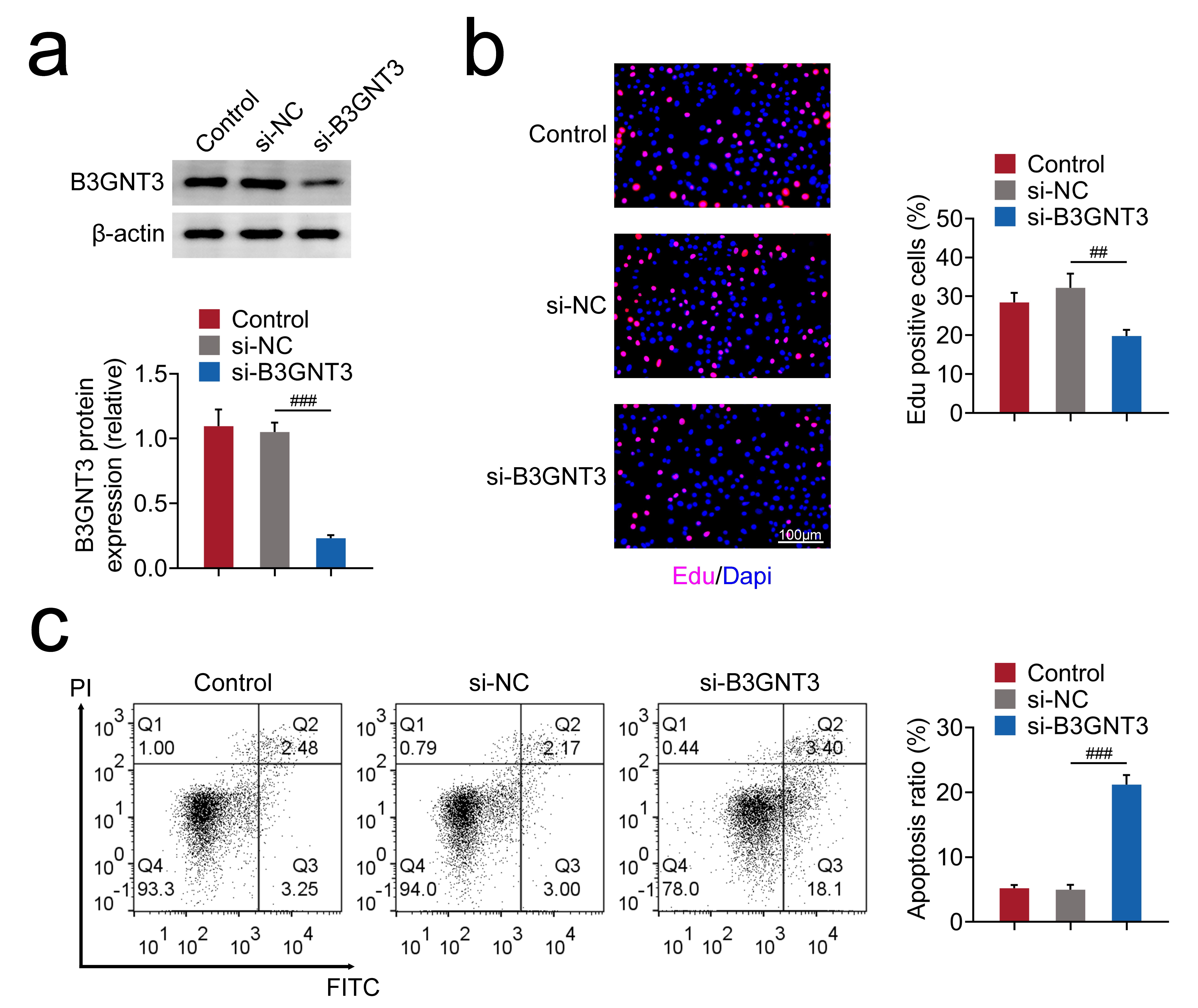 The depletion of B3GNT3 suppressed CC cell growth. (a)
Immunoblot assays indicated B3GNT3 expression levels upon the transfection of
B3GNT3 and NC siRNAs for 24 h in HCT116 cells. (b) Edu assays showed transfecting
HCT116 cells with B3GNT3 and NC siRNAs for 24 h, resulted in cell growth.
Edu-positive cells percentage was quantified. Scale bar, 100 µm. The assay
was repeated 3 times. (c) FCM assays demonstrated apoptosis levels in HCT116
cells after transfection with B3GNT3 and NC siRNAs for 24 h. The quantification
of apoptosis cell percentage was conducted. The assay was repeated 3 times.
##p < 0.01, ###p < 0.001. CC: colon cancer; NC:
negative control; B3GNT3: Beta-1,3-n-acetylglucosaminyltransferase 3; Edu:
5-Ethynyl-2’-deoxyuridine; PI: Propidium Iodide; FITC: Fluorescein
Isothiocyanate.
