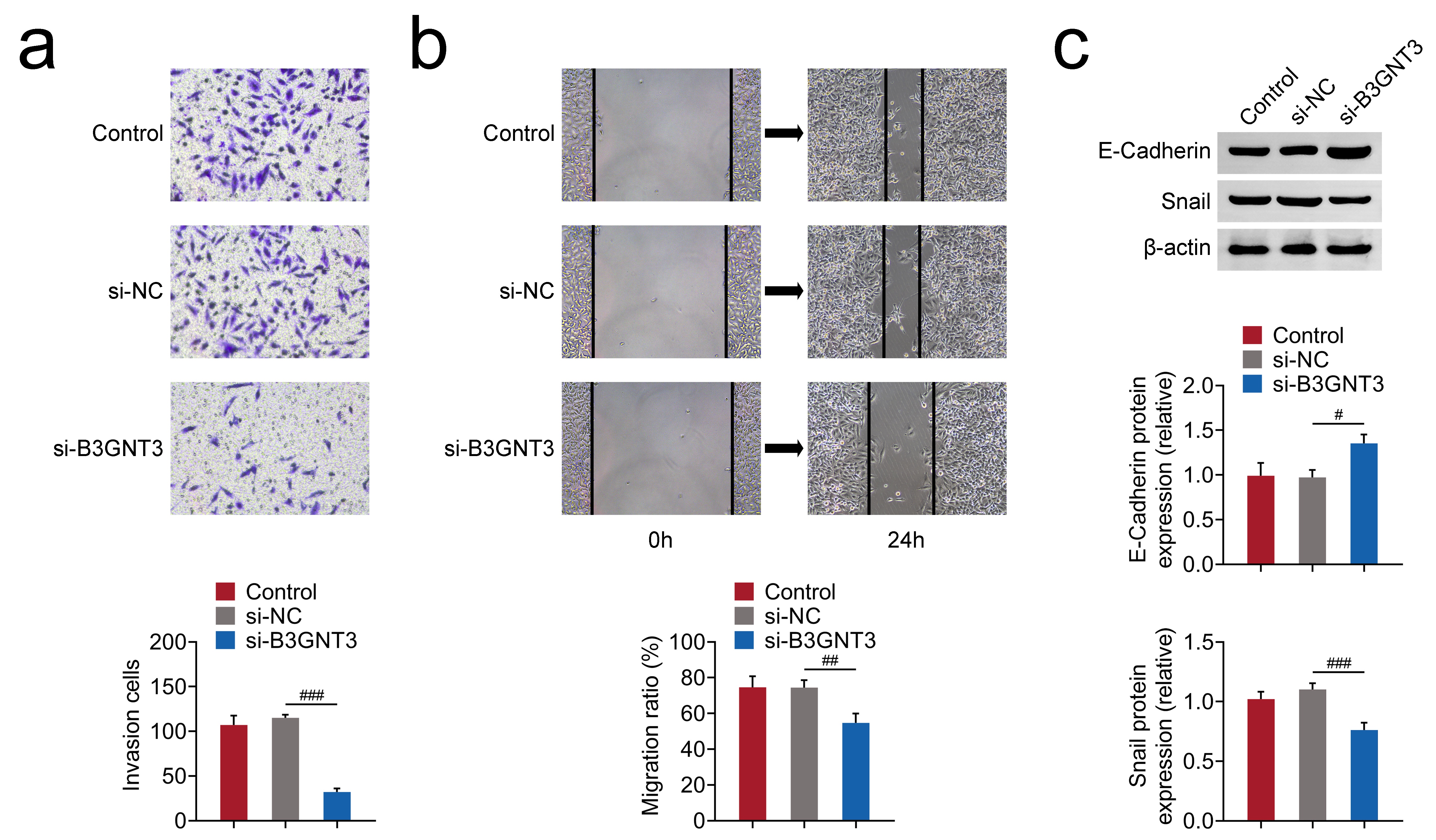 B3GNT3 knockdown restrained CC cells’ motility. (a) Transwell
assays demonstrated HCT116 cells invasion levels upon transfection of B3GNT3 and
NC siRNAs for 24 h. Invasive cell numbers were counted. The assay was repeated 3
times. (b) Wound healing assays showed the migration levels of HCT116 cells upon
the transfection of B3GNT3 and NC siRNAs for 24 h. Migration ratio was measured.
The assay was repeated 3 times. (c) Immunoblot assays indicated E-cadherin and
Snail expression level after transfection of B3GNT3 and NC siRNAs for 24 h in
HCT116 cells. The assay was repeated 3 times. #p < 0.05,
##p < 0.01, ###p < 0.001. CC: colon cancer; NC:
negative control; B3GNT3: Beta-1,3-n-acetylglucosaminyltransferase 3.