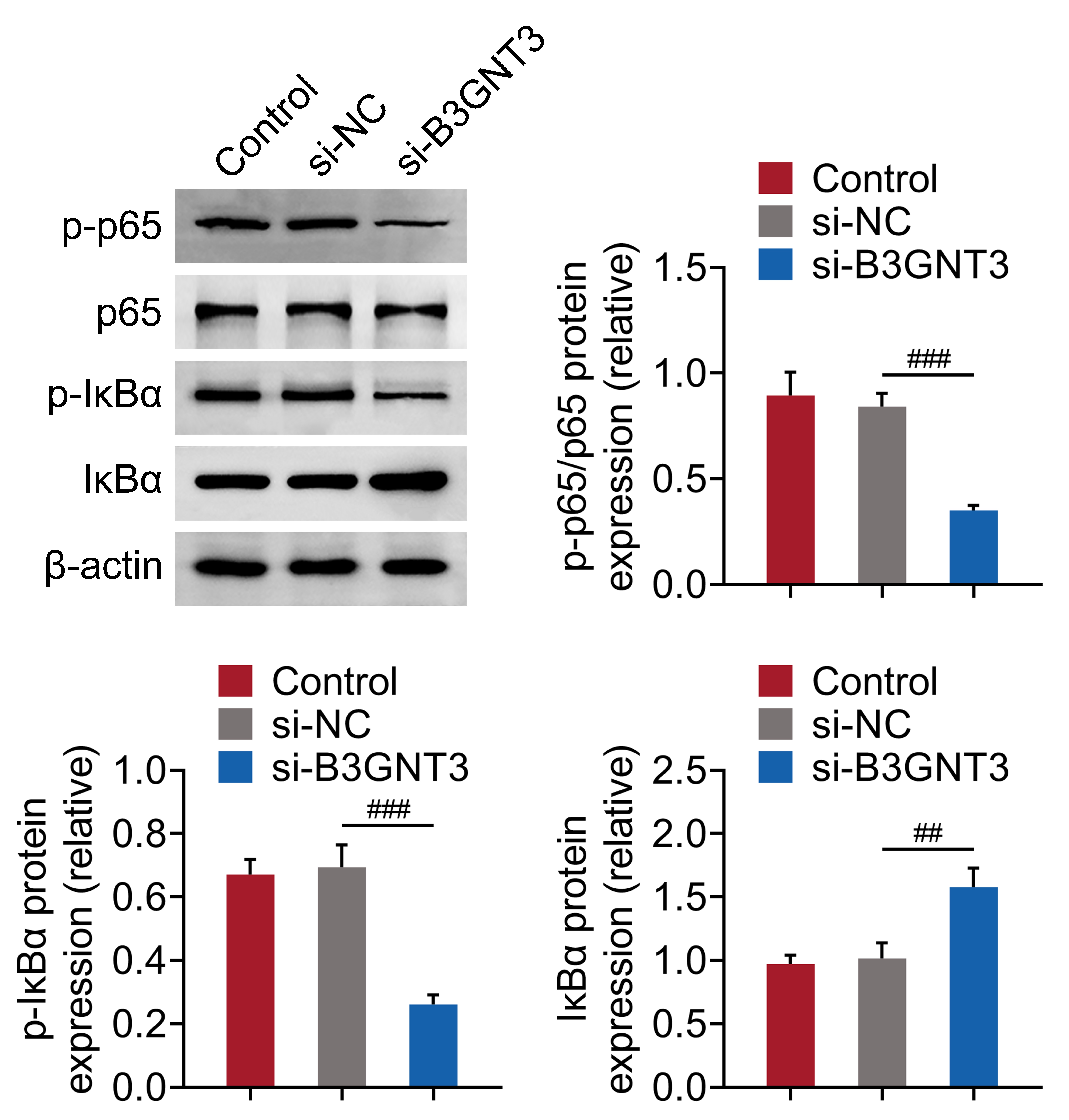 Knocking down B3GNT3 blocked the NF-κB pathway in CC
cells. Immunoblot assays indicated p65 and IκBα
phosphorylation levels after transfection of B3GNT3 and NC siRNAs for 24 h in
HCT116 cells. Phosphorylation levels of the indicated proteins were quantified.
The assay was repeated 3 times. ##p < 0.01, ###p <
0.001. CC: colon cancer; NC: negative control; B3GNT3:
Beta-1,3-n-acetylglucosaminyltransferase 3; IκBα: nuclear
factor kappa B suppressor protein alpha.