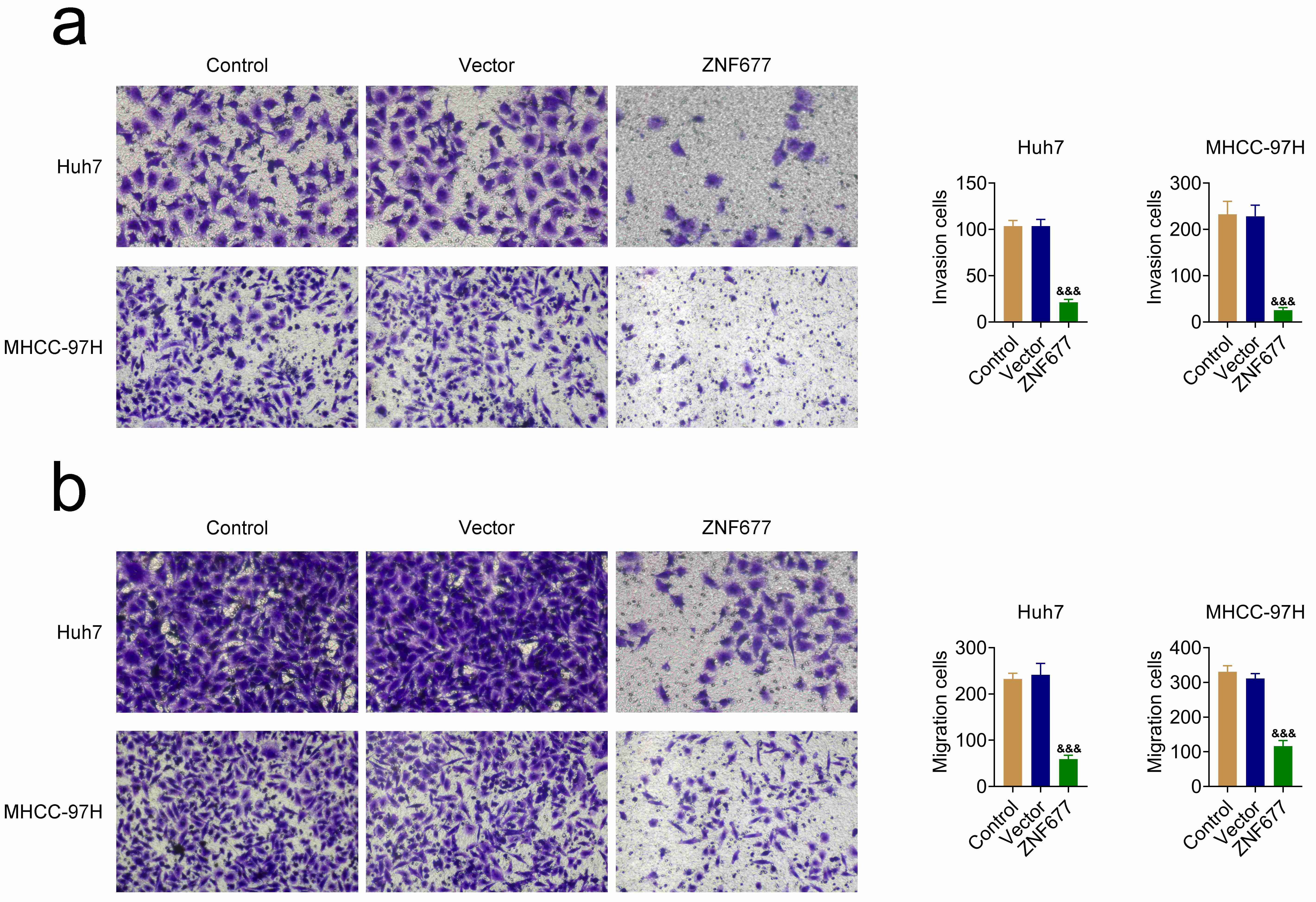 ZNF677 inhibits HCC cell migration and invasion. (a) Transwell 
migration assays displaying the migration of Huh7 and MHCC-97H cells after 24 
hours of transfection with control vectors and ZNF677 overexpression plasmids. 
The number of migrating cells was counted. (b) Transwell invasion assays 
illustrating the invasion of Huh7 and MHCC-97H cells following 24 hours of 
transfection with control vectors and ZNF677 overexpression plasmids. The number 
of invading cells was counted. &amp;&amp;&amp;p < 0.001, ZNF677 
vs. vector. ZNF: Zinc finger.