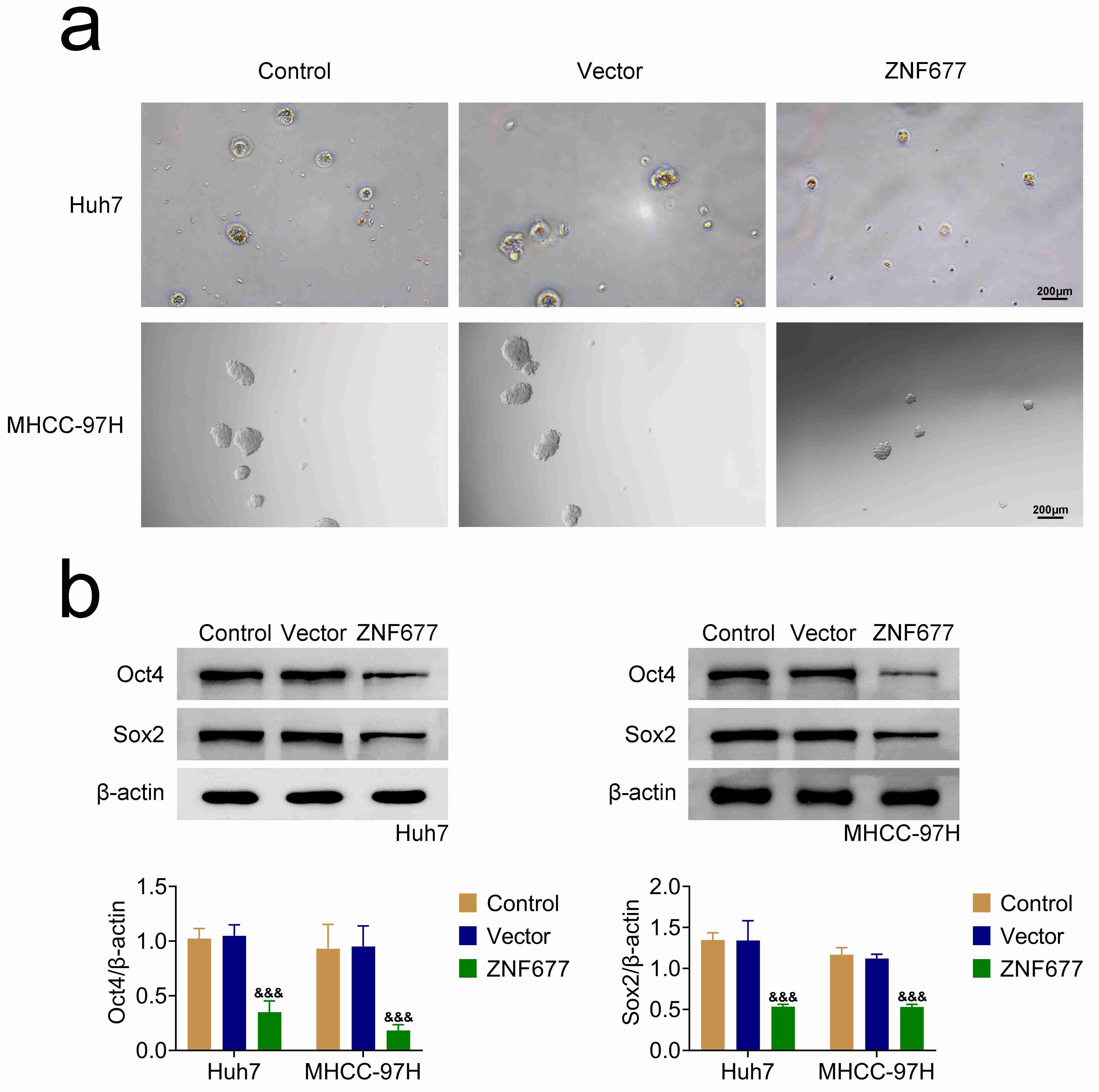 ZNF677 reduces stemness in HCC cells. (a) Sphere-forming assays 
assessing the stemness capacity of Huh7 and MHCC-97H cells following 24 hours of 
transfection with control vectors and ZNF677 overexpression plasmids. The number 
of spheres was quantified. Scale bar: 200 µm. (b) Immunoblot assays 
evaluating the expression of stemness markers Oct4 and Sox2 in Huh7 and MHCC-97H 
cells post-transfection with control vector and ZNF677 overexpression plasmids 
for 24 hours. Relative protein expression levels were compared. 
&amp;&amp;&amp;p < 0.001, ZNF677 vs. vector. ZNF: Zinc finger.