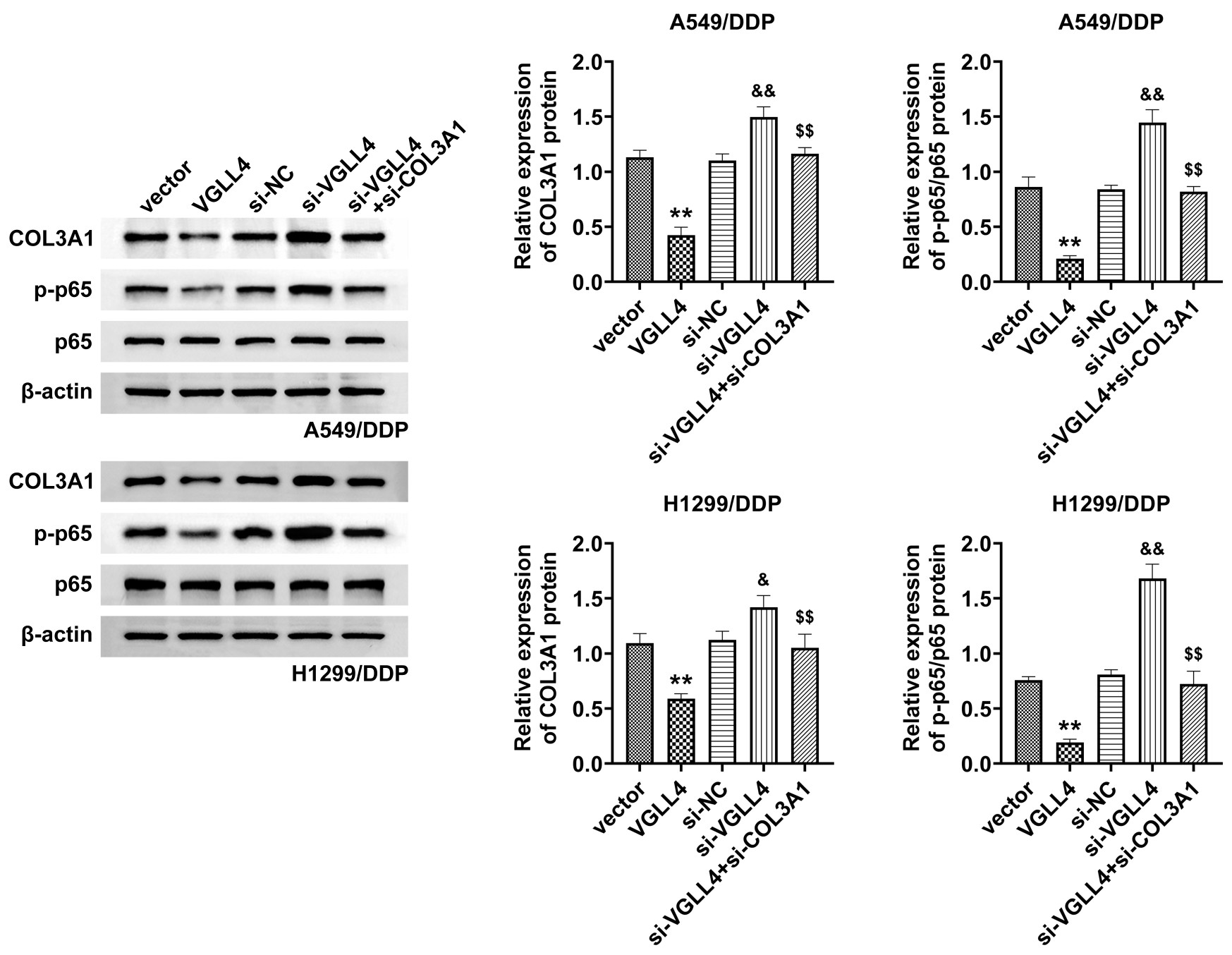 VGLL4 regulates the COL3A1/NF-κB pathway. Western blot
analysis of COL3A1 and p-p65 expression in A549/DDP and H1299/DDP cells
transfected with VGLL4, si-VGLL4, and si-VGLL4 + COL3A1.
**p < 0.01 compared with vector
group; &p < 0.05,
&&p < 0.01 compared with si-NC
group; $$p < 0.01 compared
with si-VGLL4 group. VGLL4: vestigial-like protein 4; DDP: cisplatin; COL3A1:
si-NC: siRNA-negative control.