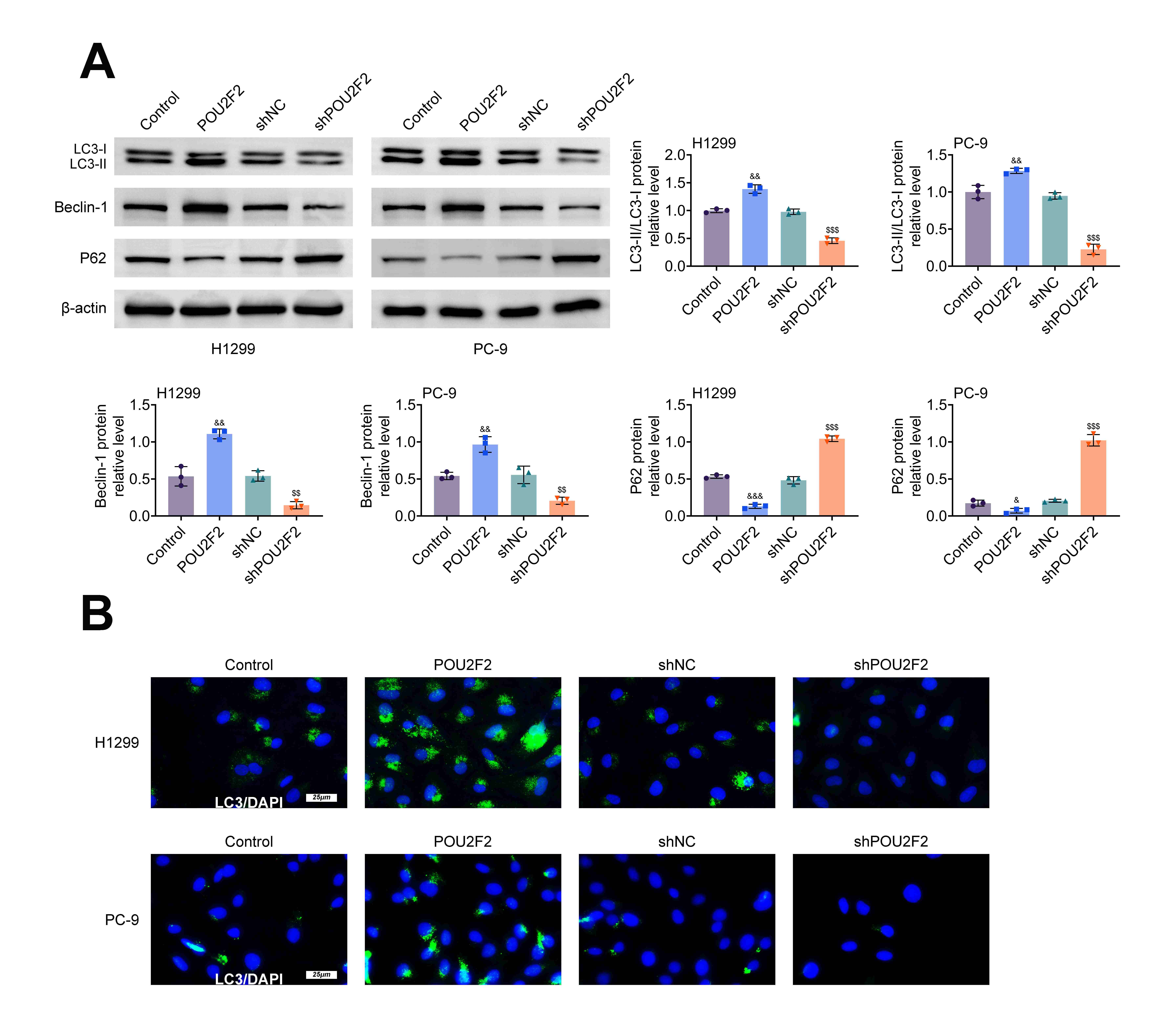 POU2F2 heightened autophagy in LUAD. (A) The protein expressions of LC3-I, LC3-II, Beclin-1 and P62 were measured in the Control, POU2F2, shNC and shPOU2F2 groups through western blot. (B) The fluorescence intensity of LC3 was verified in the Control, POU2F2, shNC and shPOU2F2 groups through IF assay. &p < 0.05, &&p < 0.01, &&&p < 0.001 vs. the Control group; $$p < 0.01, $$$p < 0.001 vs. the shNC group. POU2F2: POU class 2 homeobox 2; LUAD: Lung adenocarcinoma; IF: Immunofluorescence.