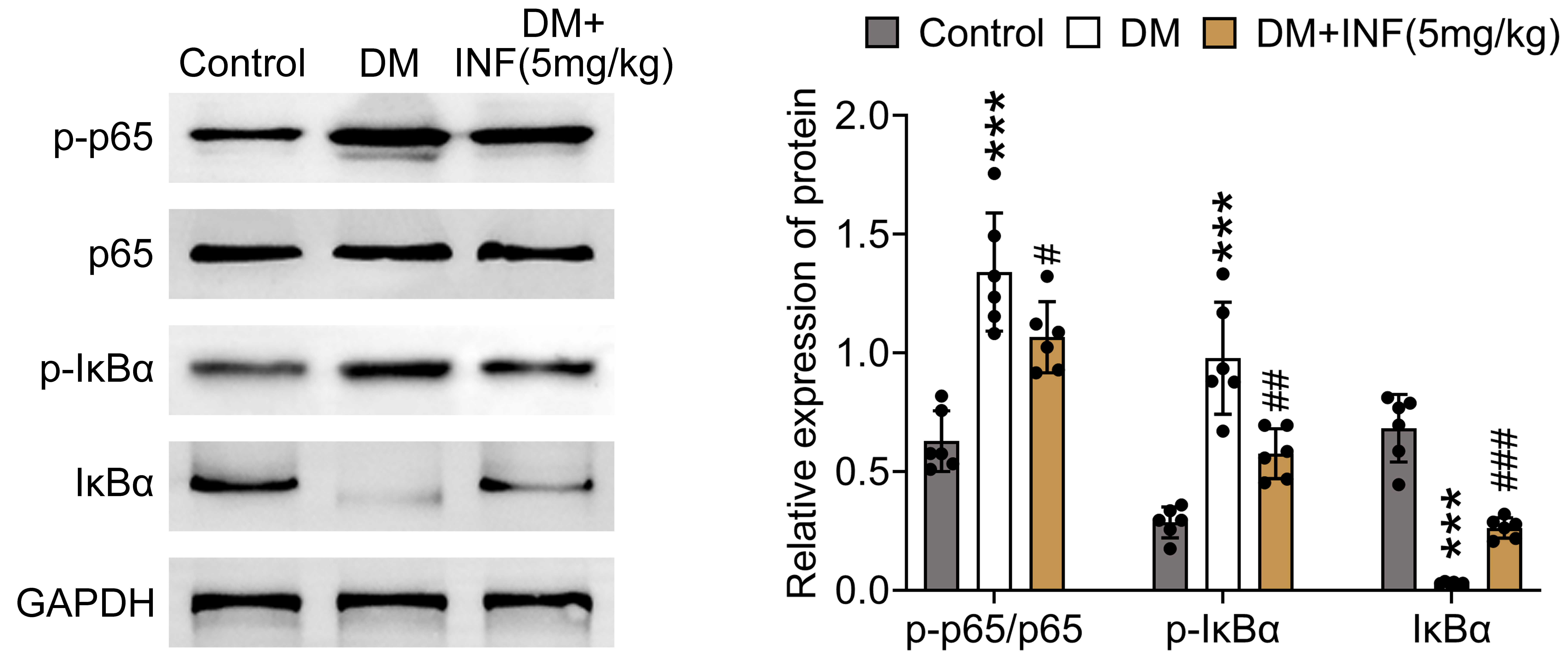 Infliximab refrained the
NF-κB pathway in DM mice. The mice were divided into Control, DM and DM
+ 5 mg/kg INF groups. The protein expressions of p-p65, p65, p-IκBα and
IκBα were analyzed by western blot. N = 6 mice per group.
***p < 0.001 vs. Control; #p <
0.05, ##p < 0.01, ###p < 0.001 vs.
DM. DM: diabetes mellitus; INF: Infliximab; GAPDH: glyceraldehyde-3-phosphate
dehydrogenase; IκBα: inhibitory subunit of nuclear factor kappa
B alpha.