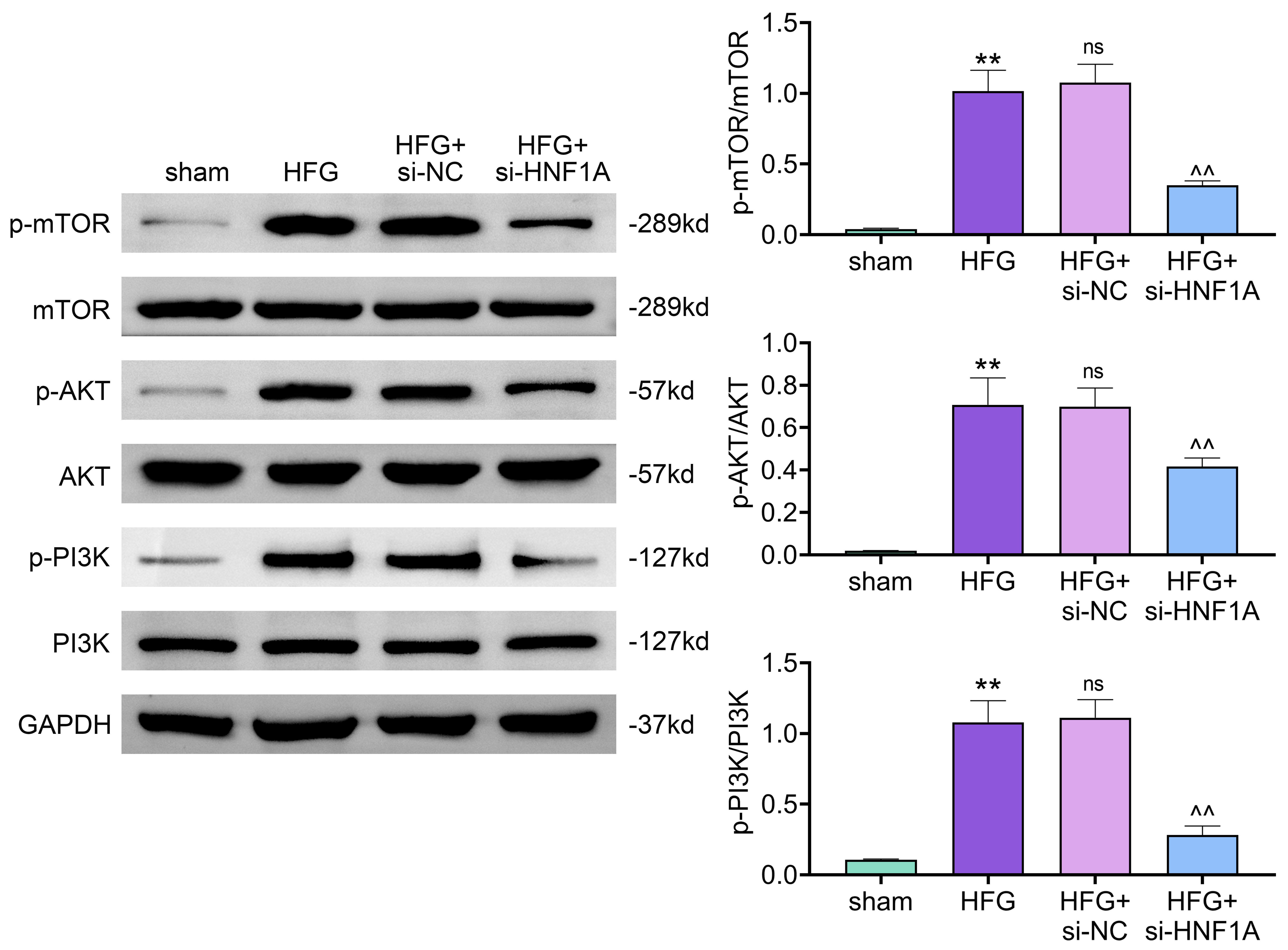 Silencing of HNF1A retarded the PI3K/AKT/mTOR pathway. Groups
were separated into the sham, HFG, HFG + si-NC and HFG + si-HNF1A group. The
protein expressions of p-mTOR, mTOR, p-AKT,
AKT, p-PI3K and PI3K were ascertained by western blot. **p <
0.01 vs. the sham group; ^^p
< 0.01 vs. the HFG + si-NC group; no significance (ns): the HFG group
vs. the HFG + si-NC group. HFG: high-fat diet plus hyperglycemia; si-NC:
si-negative control; HNF1A: Hepatocyte nuclear factor 1 homeobox A;
p-mTOR: phosphorylation-mammalian target of
rapamycin; p-AKT: phosphorylation-protein kinase B; p-PI3K:
phosphorylation-phosphatidylinositol 3-kinase.