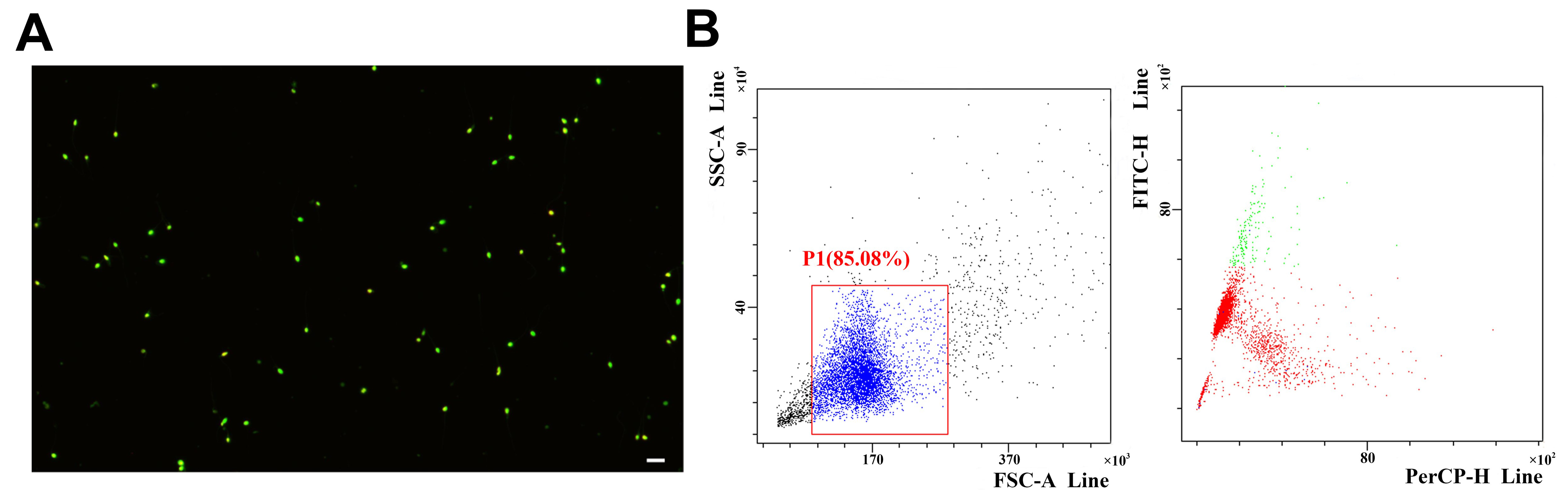 Measurement of sperm DFI. (A) Sperm DFI was detected by
fluorescence microscopy. (B) Sperm DFI was detected by flow cytometry. Green
indicates normal sperm DFI, and red/orange indicates high sperm DFI. Scale bar:
10 µm. SSC: side scatter; FSC: forward scatter; FITC: fluorescein
isothiocyanate; PerCP: peridinin-chlorophyll-protein complex.