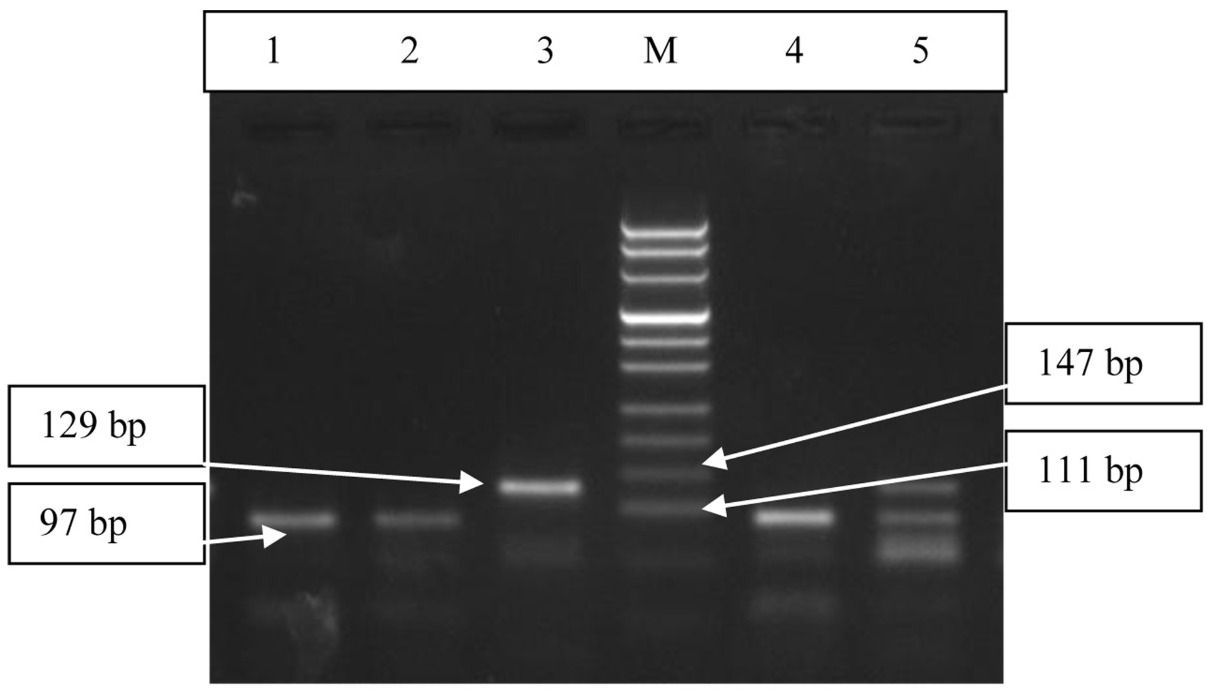 Gel image for MMP3 polymorphism.