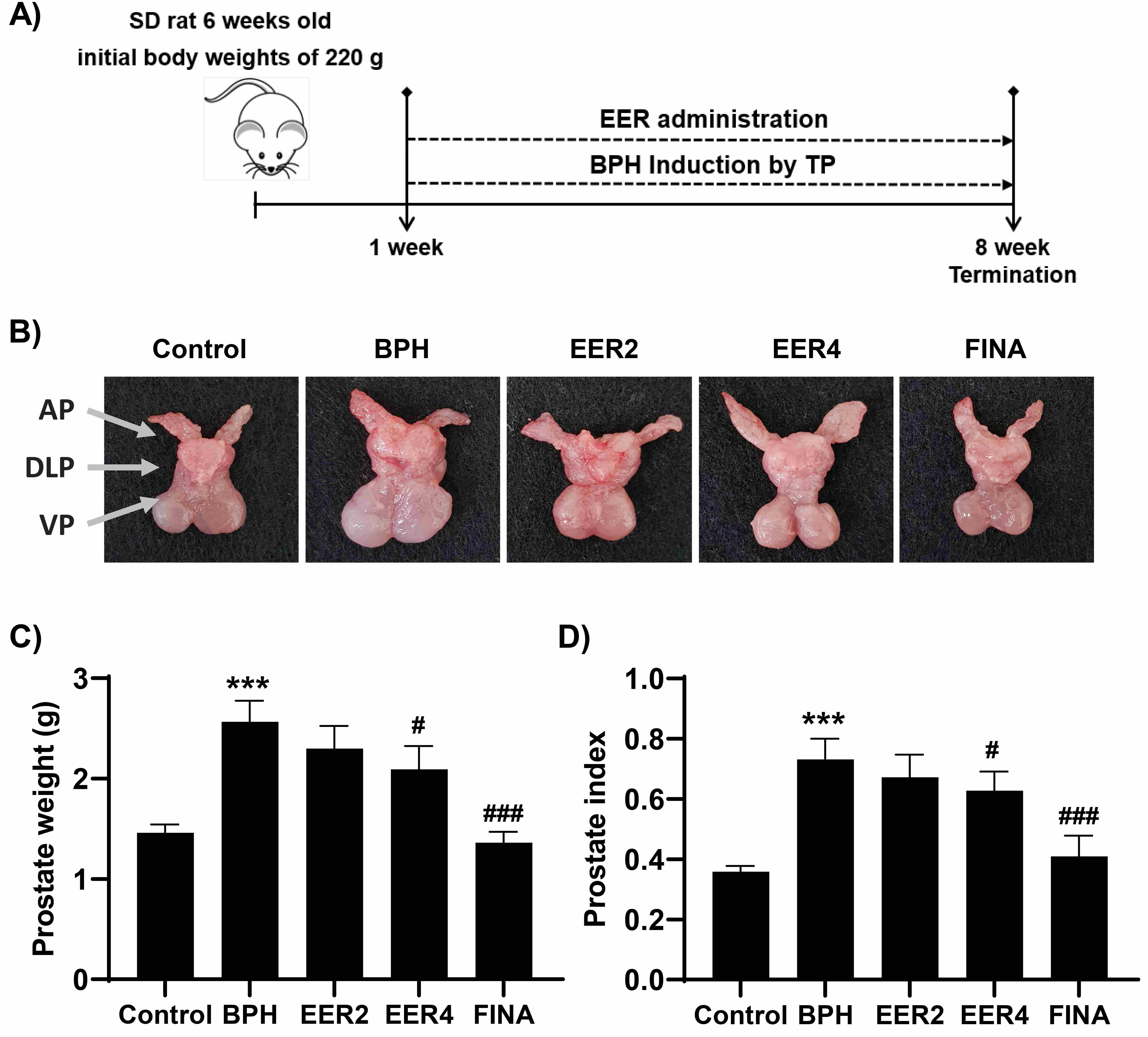 Effects of EER on prostatic hypertrophy in SD rats with
TP-induced BPH. (A) Schematic diagram of the experimental procedure. (B)
Representative photographs showing changes in prostate size in each experimental
group (VP: ventral prostate; DLP: dorsolateral prostate; AP: anterior prostate).
(C,D) Changes in prostate weight (C) and prostate index (D)
(***p < 0.001 vs. Control; #p <
0.05 and ###p < 0.001 vs. BPH). SD: Sprague-Dawley;
EER: Euodia rutaecarpa fruit; BPH: benign prostatic hyperplasia; TP:
testosterone propionate; FINA: finasteride.