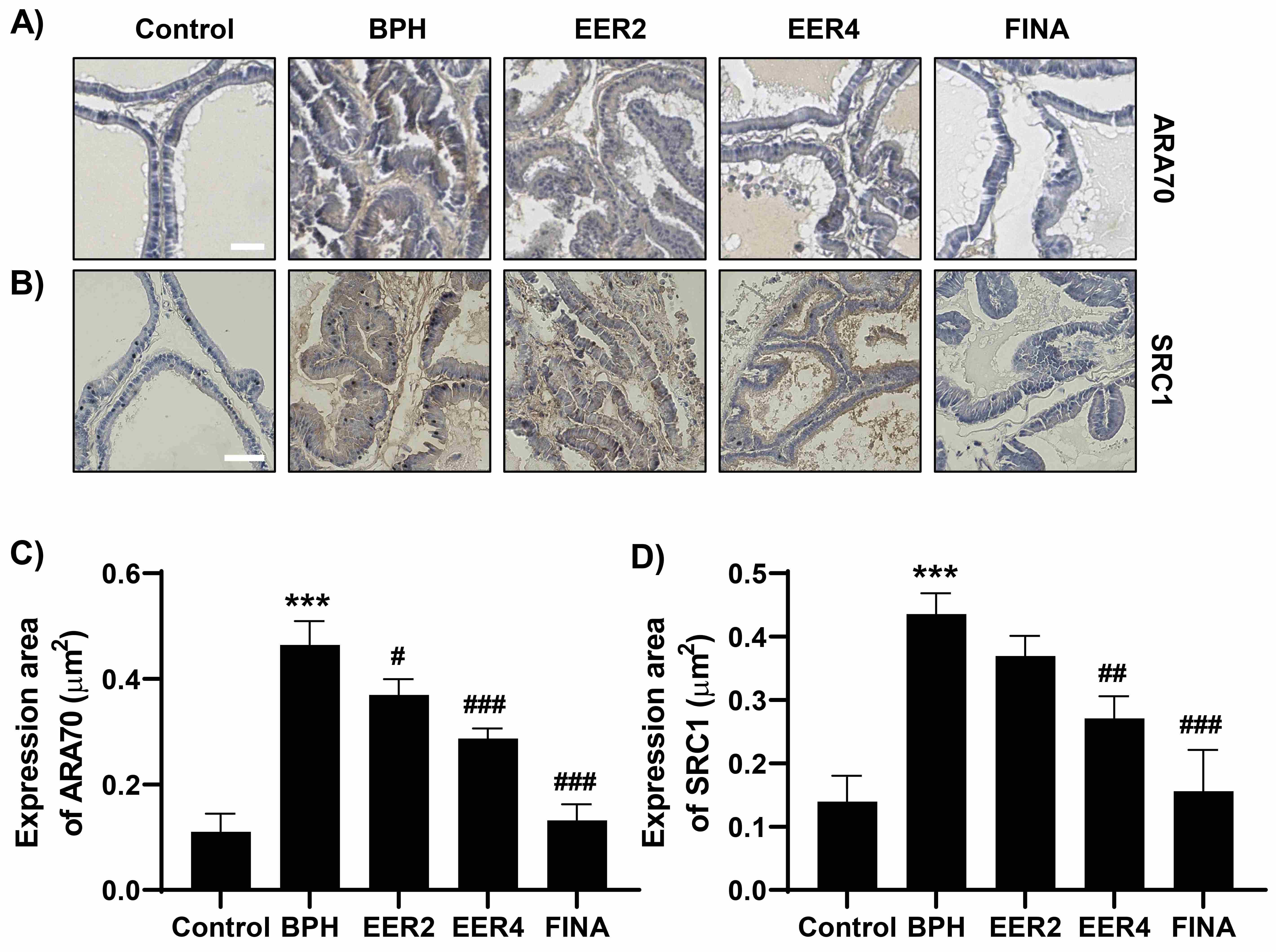 EER attenuates expression of ARA70 and SRC1 increased in
prostates of TP-induced BPH rats. Expression levels of ARA70 and SRC1 in prostate tissues of each experimental group were examined through IHC (A,C)
and quantified (B,D, ***p < 0.001 vs. Control;
#p < 0.05, ##p < 0.01, ###p
< 0.001 vs. BPH). BPH: benign prostatic hyperplasia; EER:
Euodia rutaecarpa fruit; FINA: finasteride; ARA70: AR-associated protein
70; SRC1: steroid receptor co-activator-1.