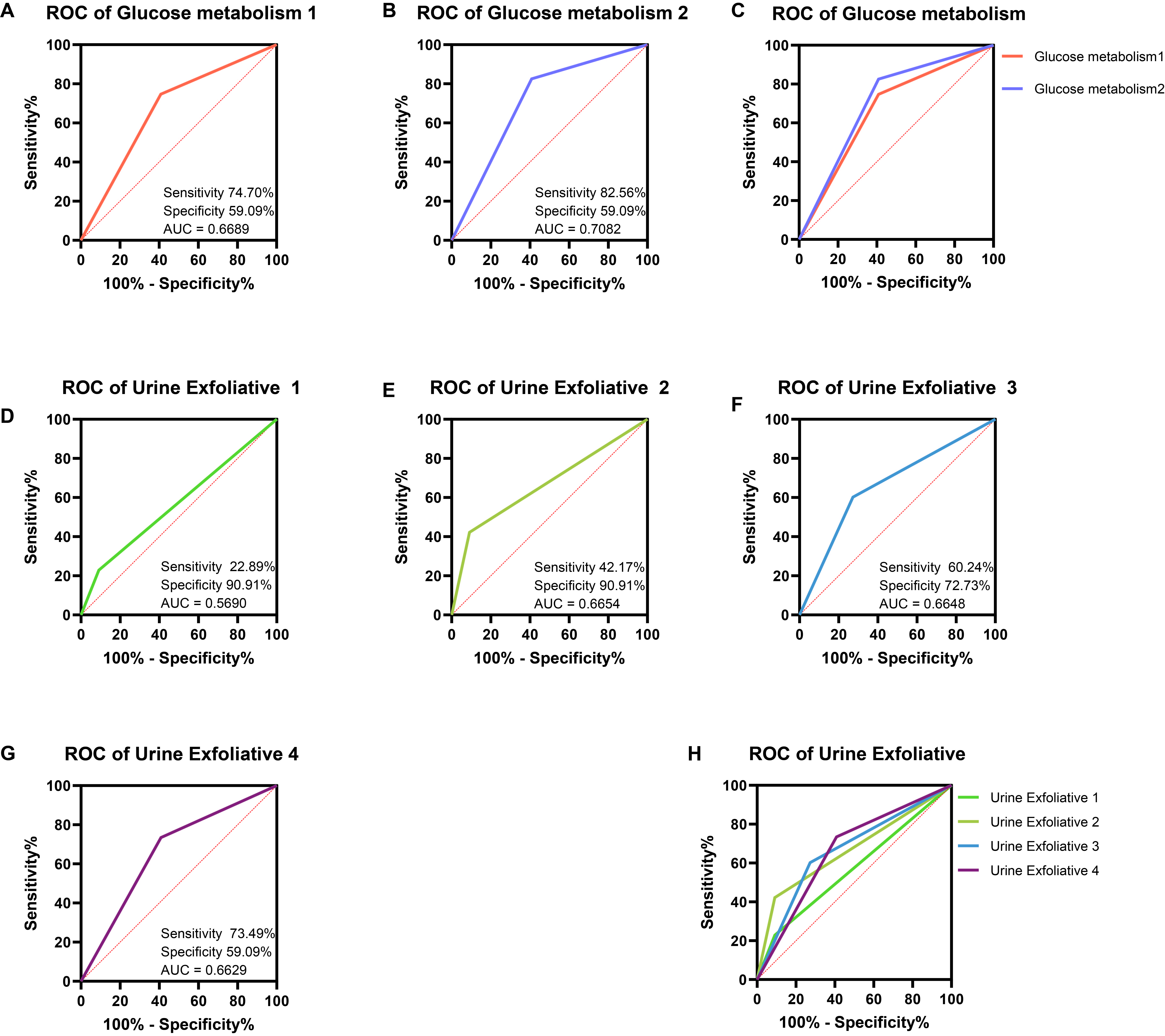 The diagnostic efficacy of glucose metabolism and urine 
exfoliation. (A) ROC curve of “Glucose metabolism 1”; (B) ROC curve of 
“Glucose metabolism 2”; (C) ROC curve of “Urine Exfoliation 1”; (D) ROC curve 
of “Urine Exfoliation 2”; (E) ROC curve of “Urine Exfoliation 3”; (F) ROC 
curve of “Urine Exfoliation 4”; (G) ROC curves of “Glucose metabolism 1” and 
“Glucose metabolism 2”; (H) ROC curves of “Urine Exfoliation 1–4”. ROC: 
Receiver Operating Characteristic; AUC: Area Under Curve.