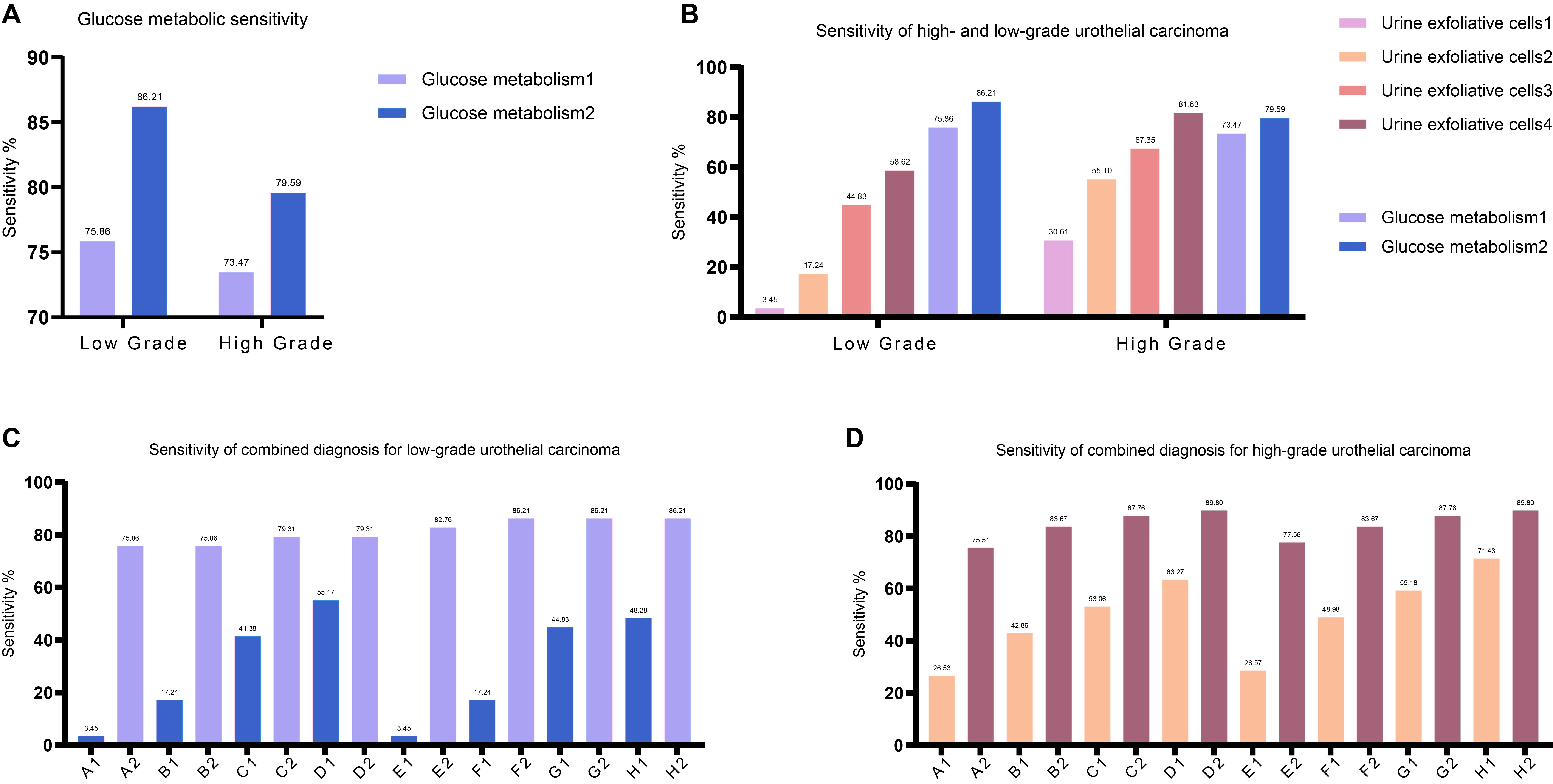 Comparison of sensitivity between high-grade and low-grade 
urothelial carcinoma. (A) Sensitivity of glucose metabolism test toward 
high-grade and low-grade urothelial carcinoma; (B) Sensitivity of glucose 
metabolism test and urine exfoliation toward high-grade and low-grade urothelial 
carcinoma; (C) Sensitivity of combined diagnosis for low-grade urothelial 
carcinoma; (D) Sensitivity of combined diagnosis for high-grade urothelial 
carcinoma.