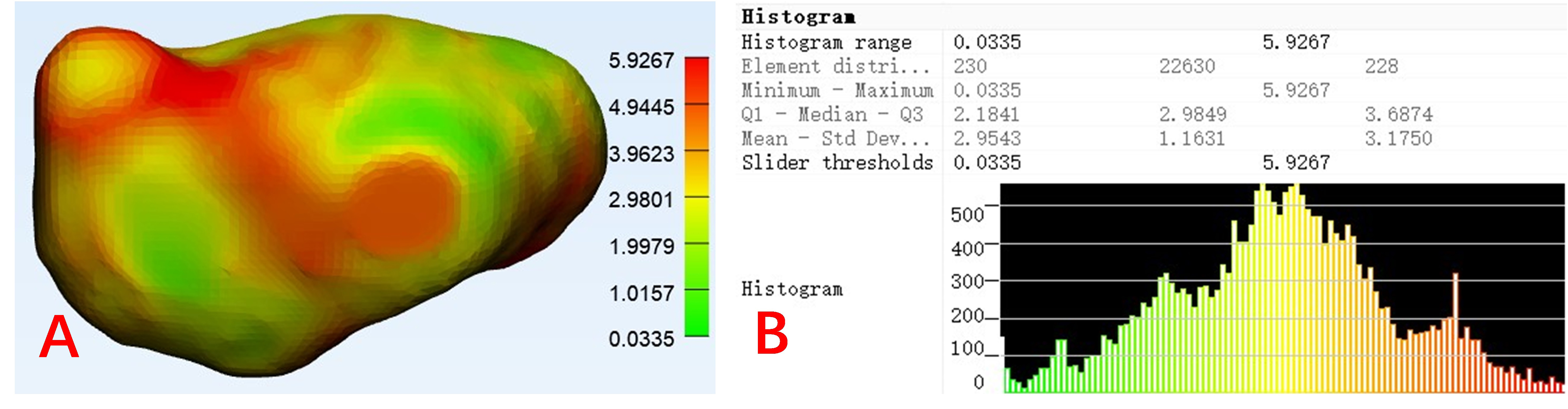 Bladder wall thickness analysis in 3-matic. (A) Bladder wall 
performed using 3-matic software. Gradient shows thinnest wall in green, medium 
wall thickness in yellow, and thickest wall in red. (B) The wall thickness 
analysis shows the median bladder wall thickness was 2.9849 mm.