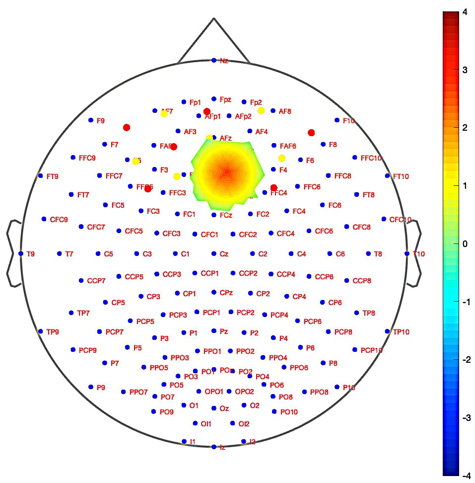 Topographic images of the PFC showing activation patterns in
response to congruent stimuli, derived from changes in activation levels across
participant groups using the CNR method.